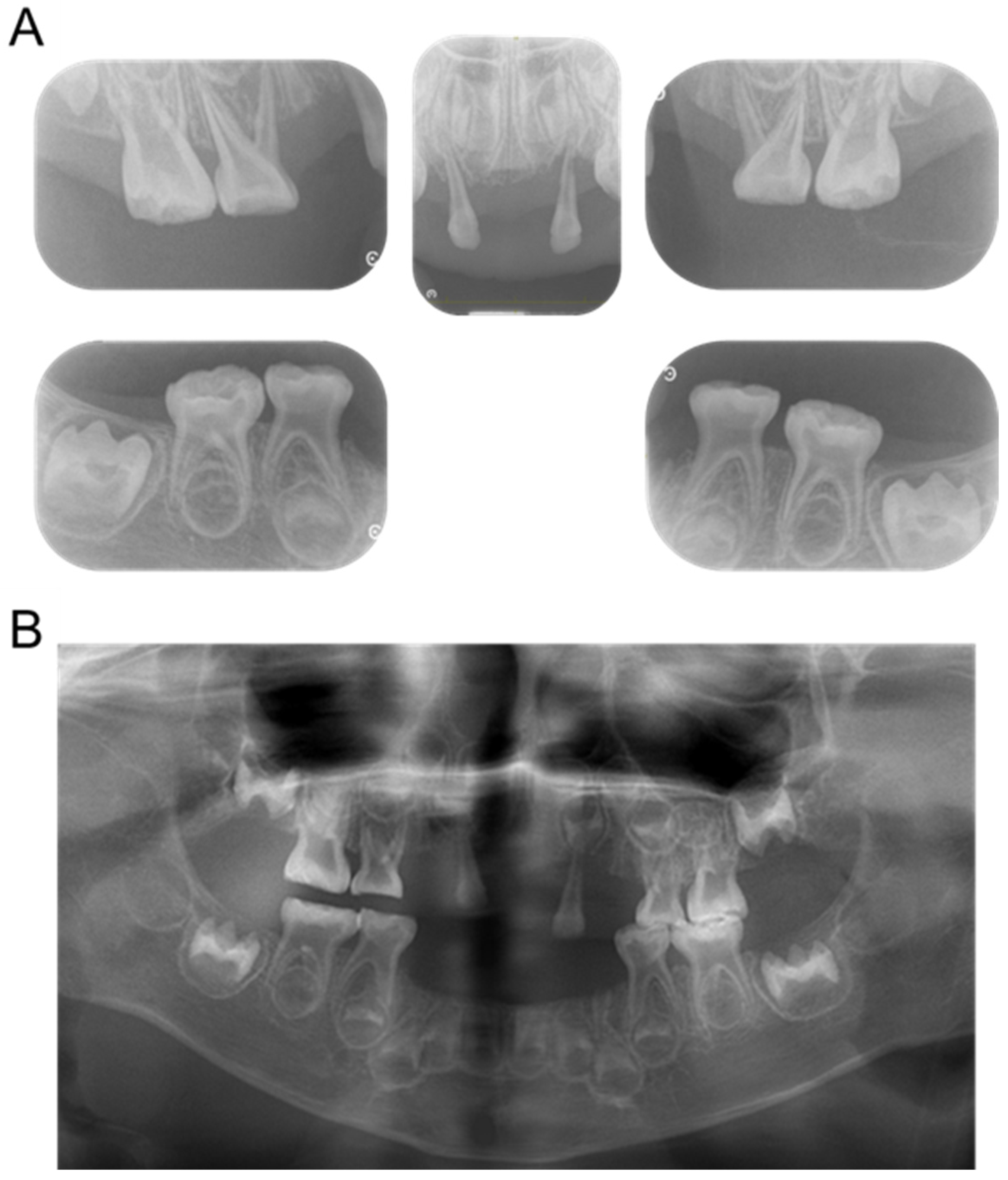 Children 12 00061 g005