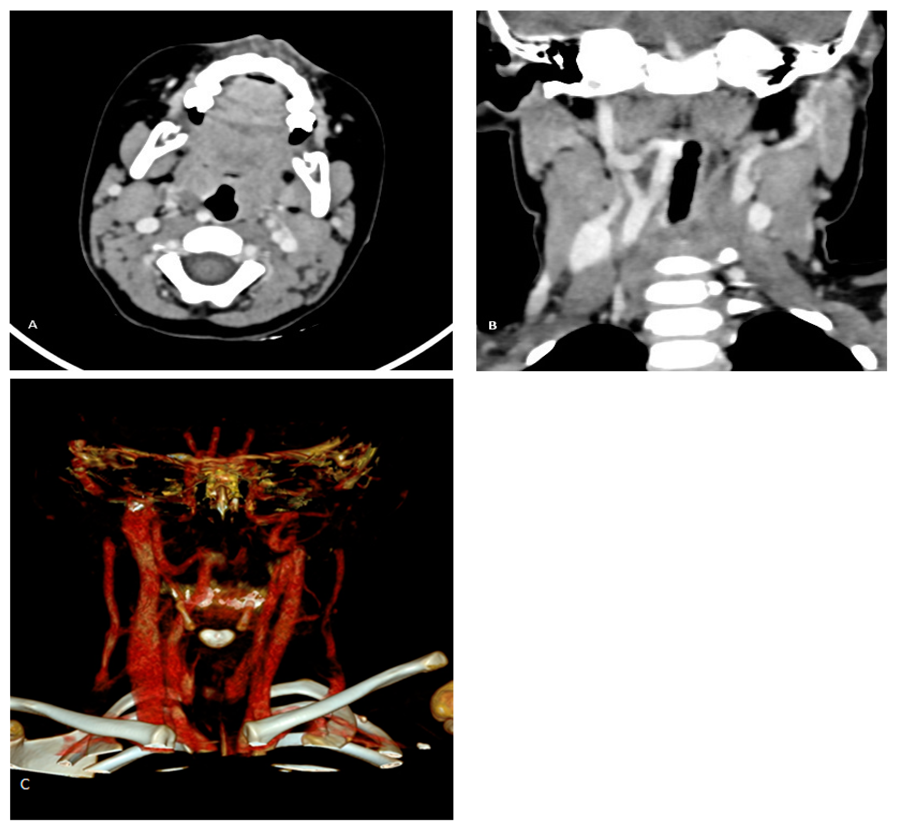 Children 12 00139 g001