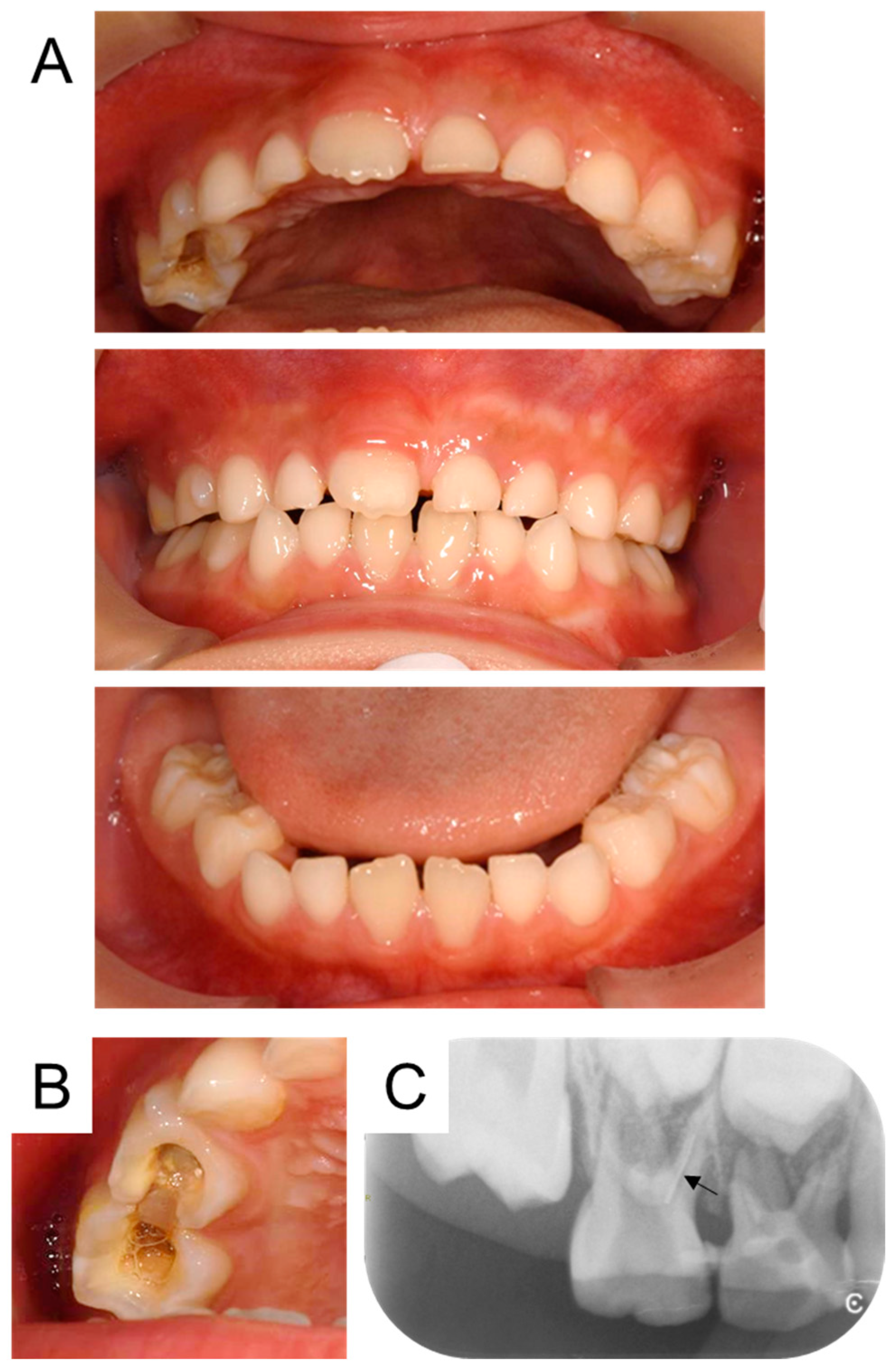Children 12 00149 g001