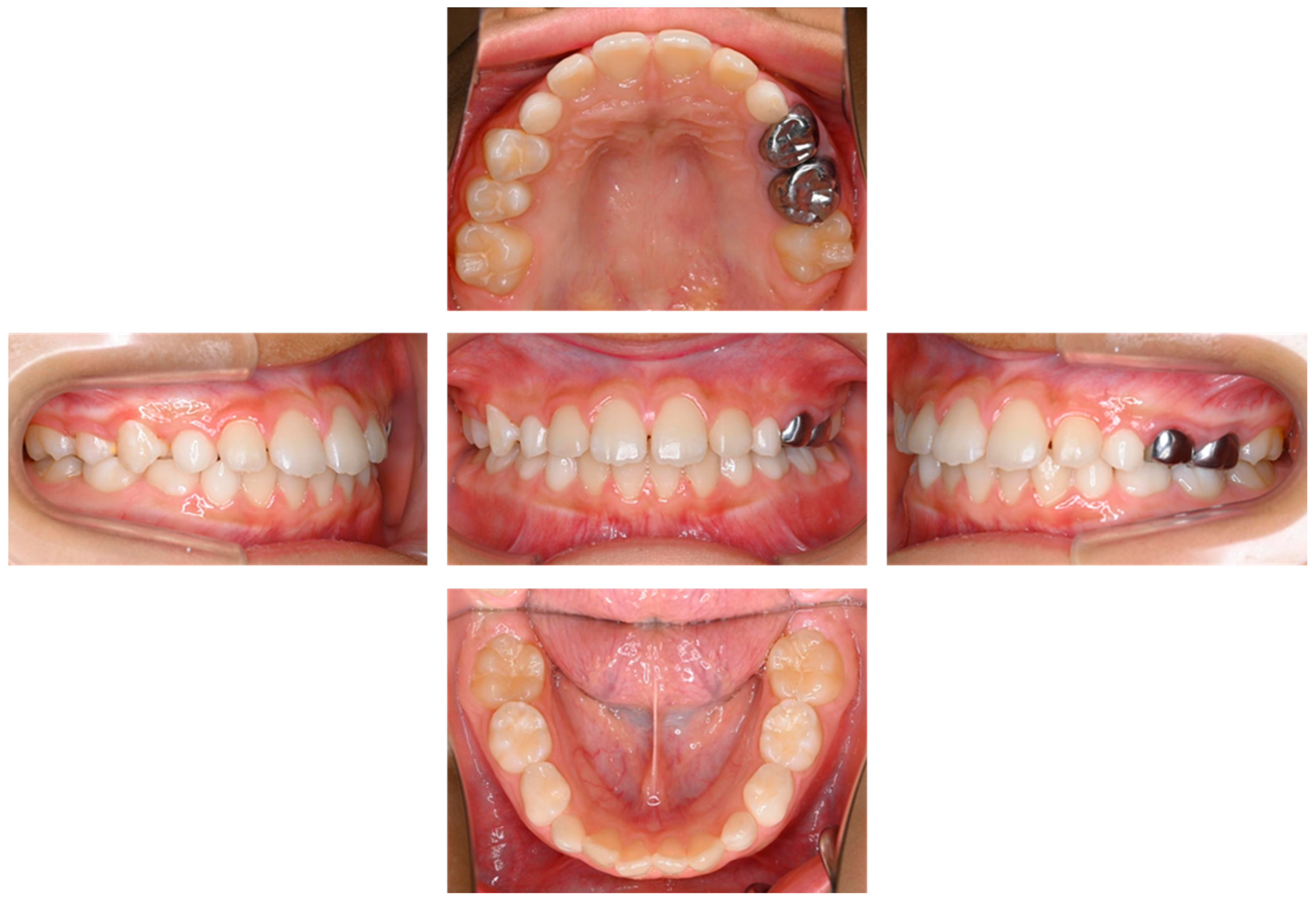 Children 12 00149 g004