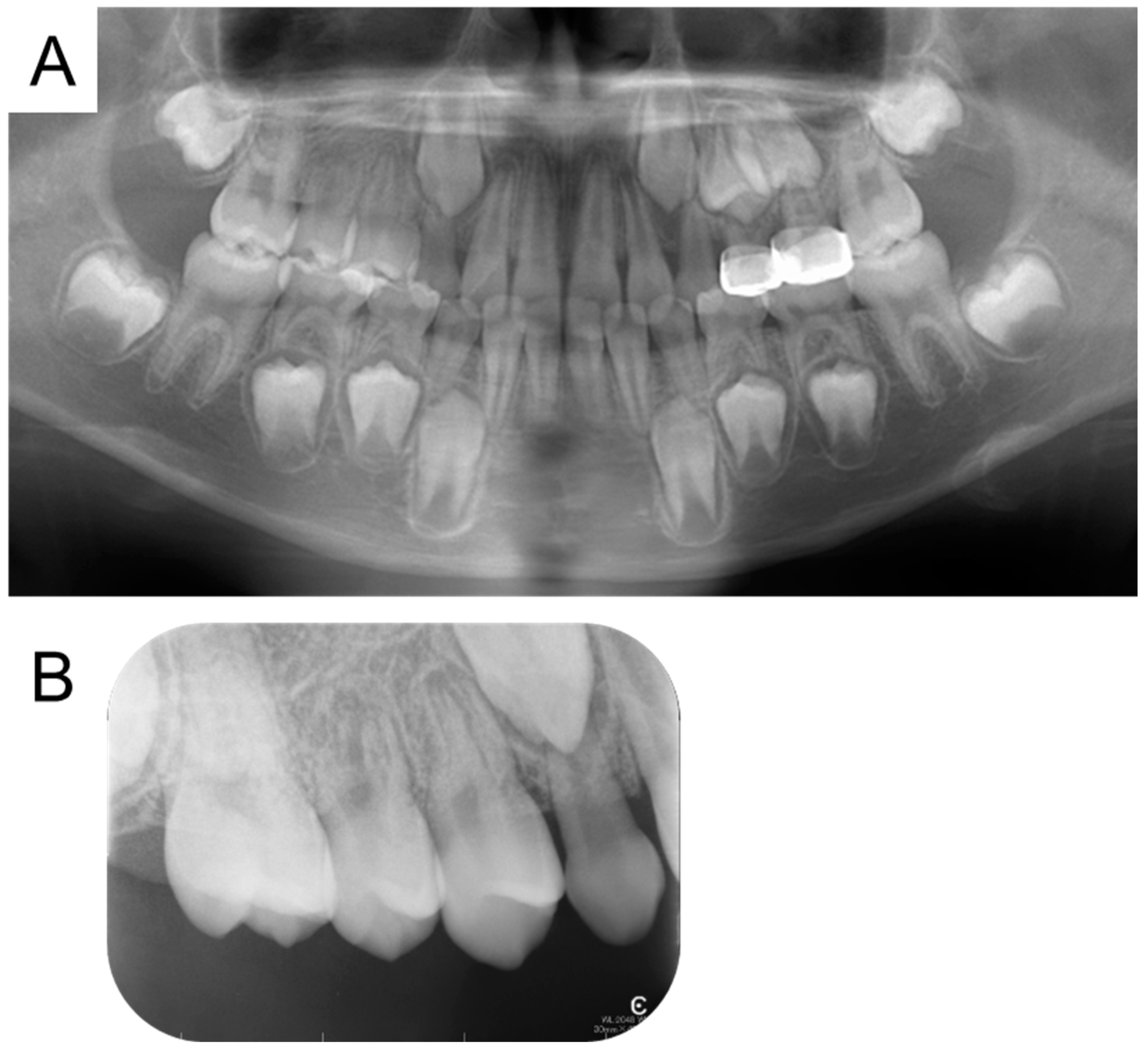 Children 12 00149 g005