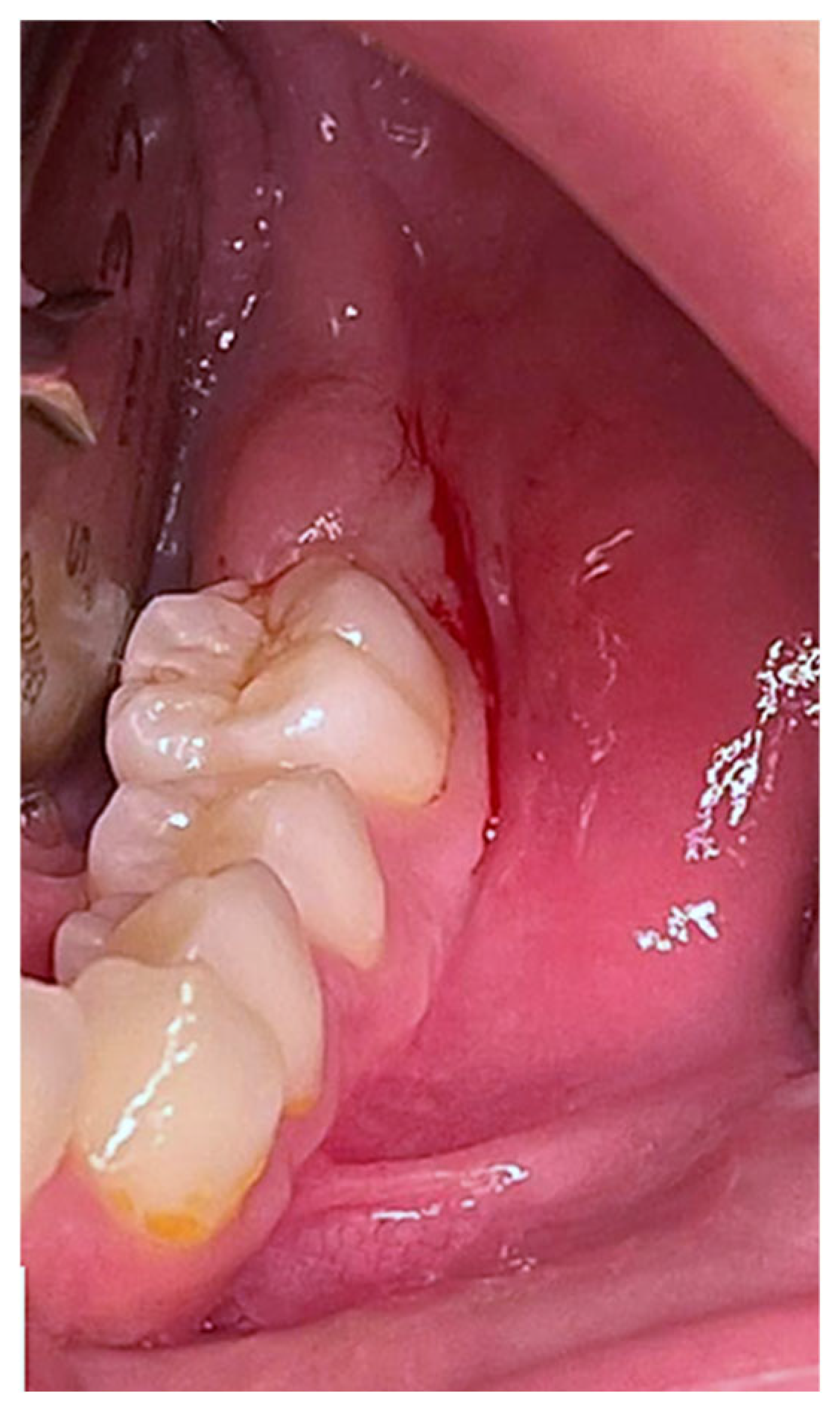 Children 12 00158 g001