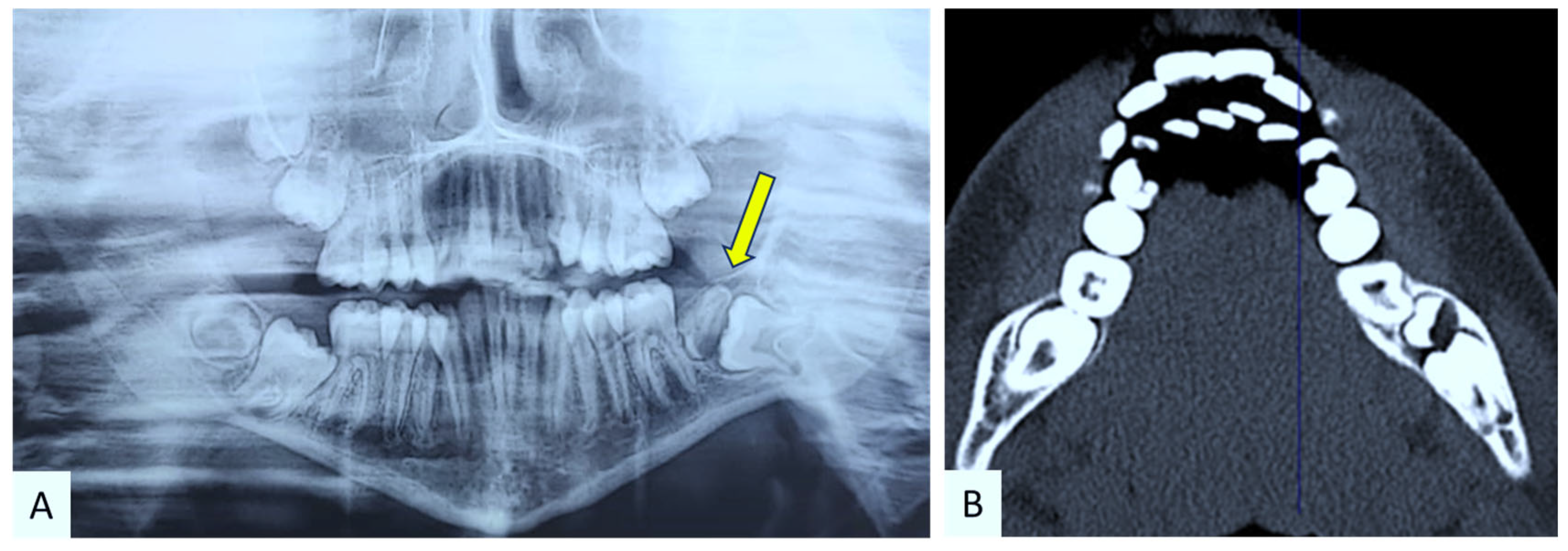 Children 12 00158 g002