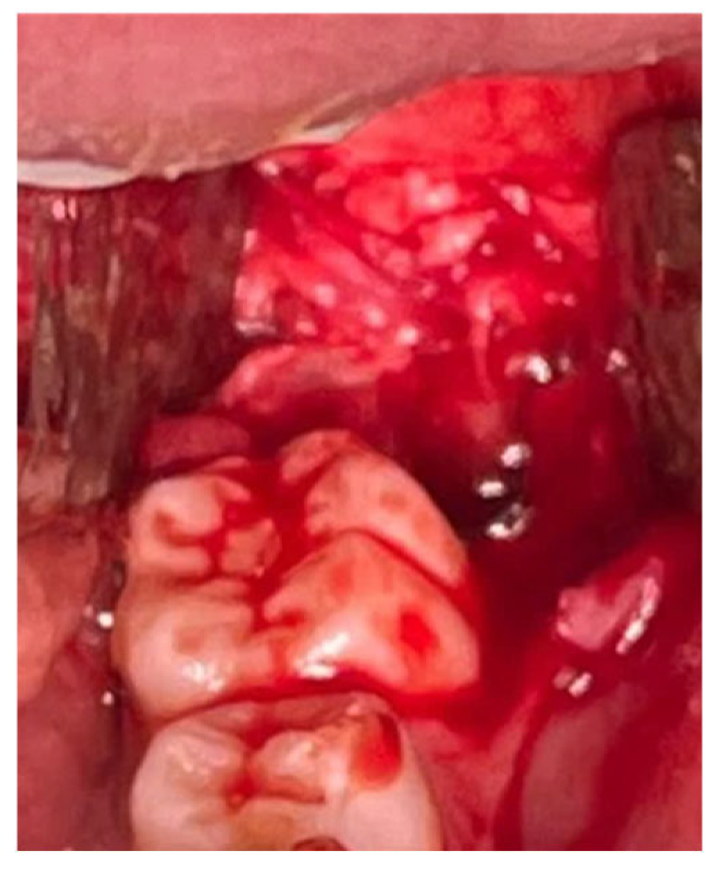 Children 12 00158 g003