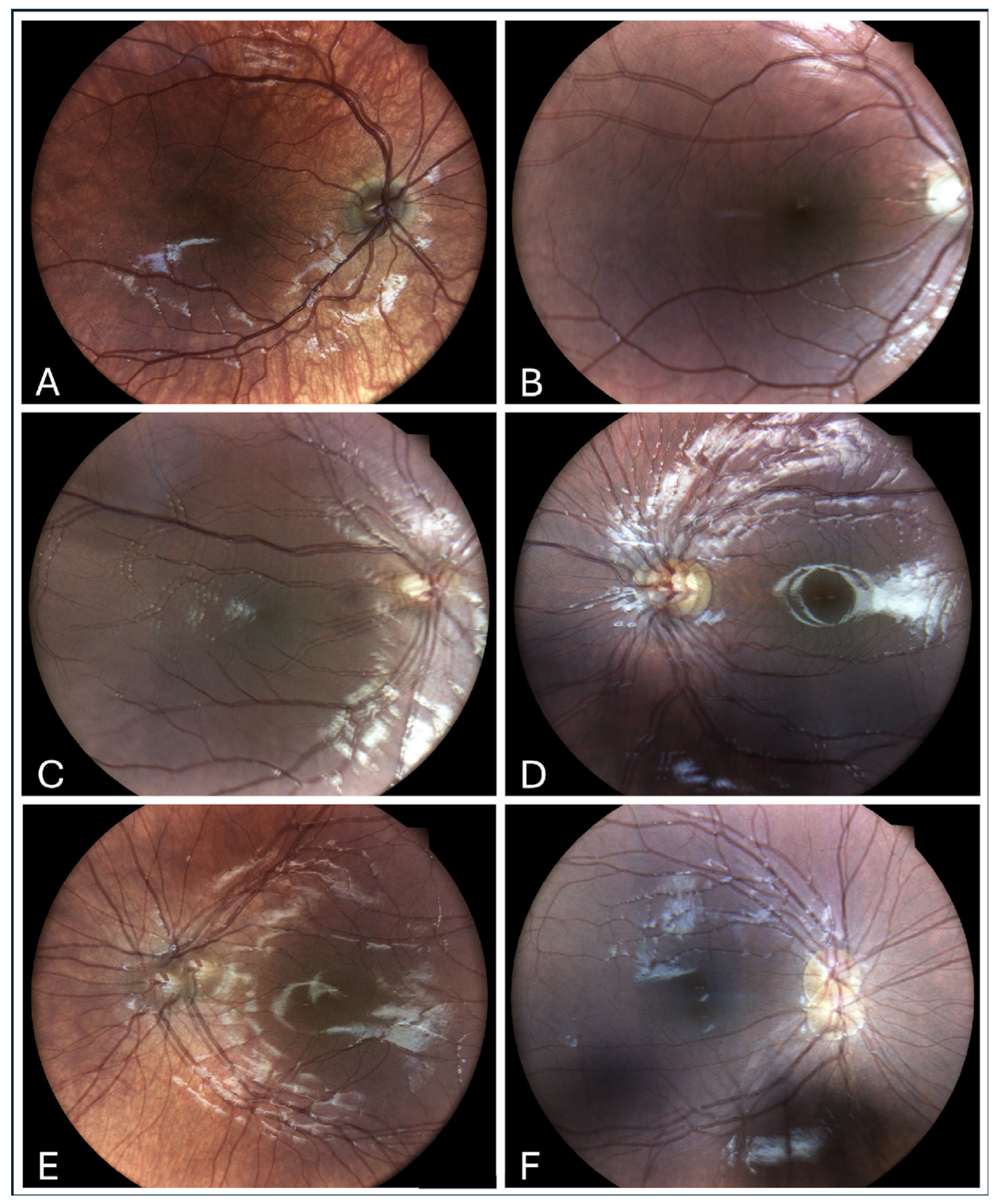Children 12 00211 g002