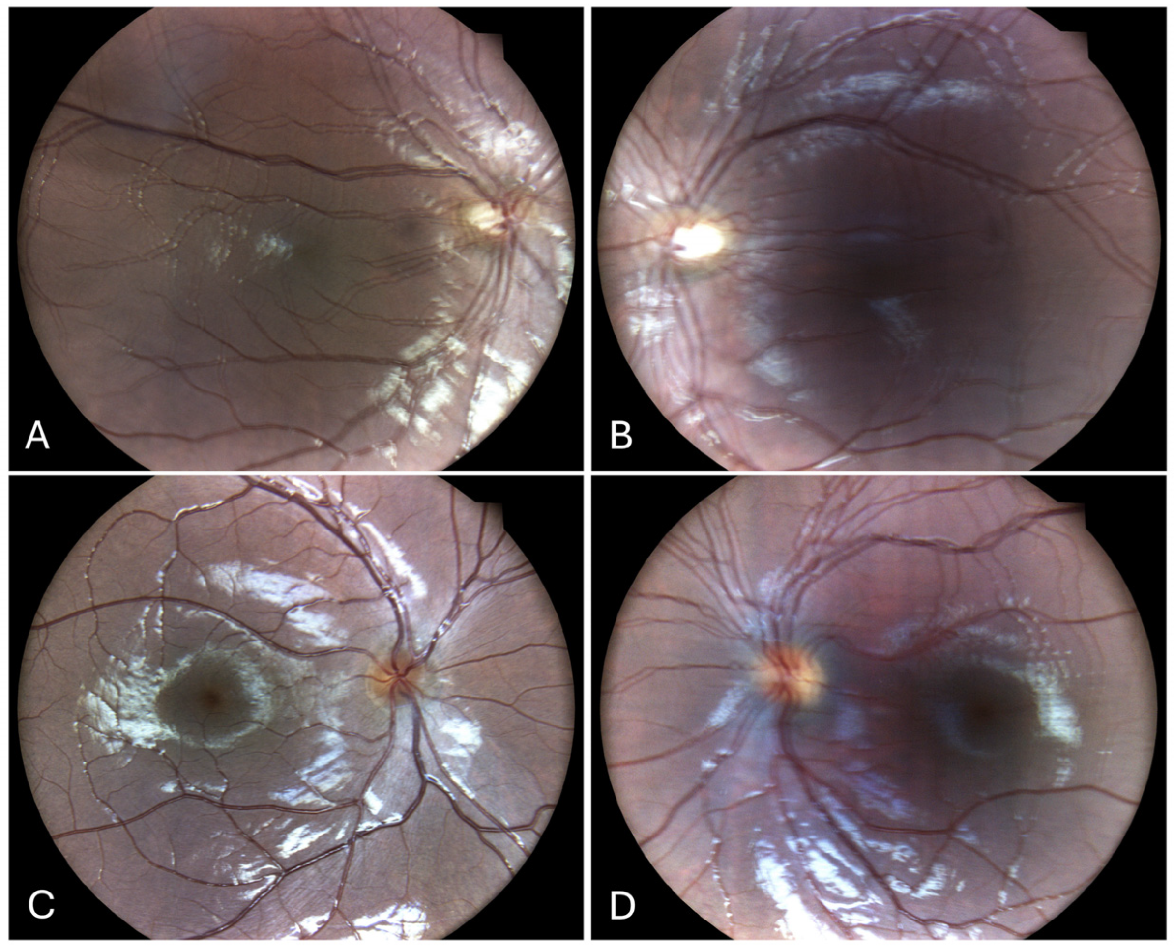 Children 12 00211 g003