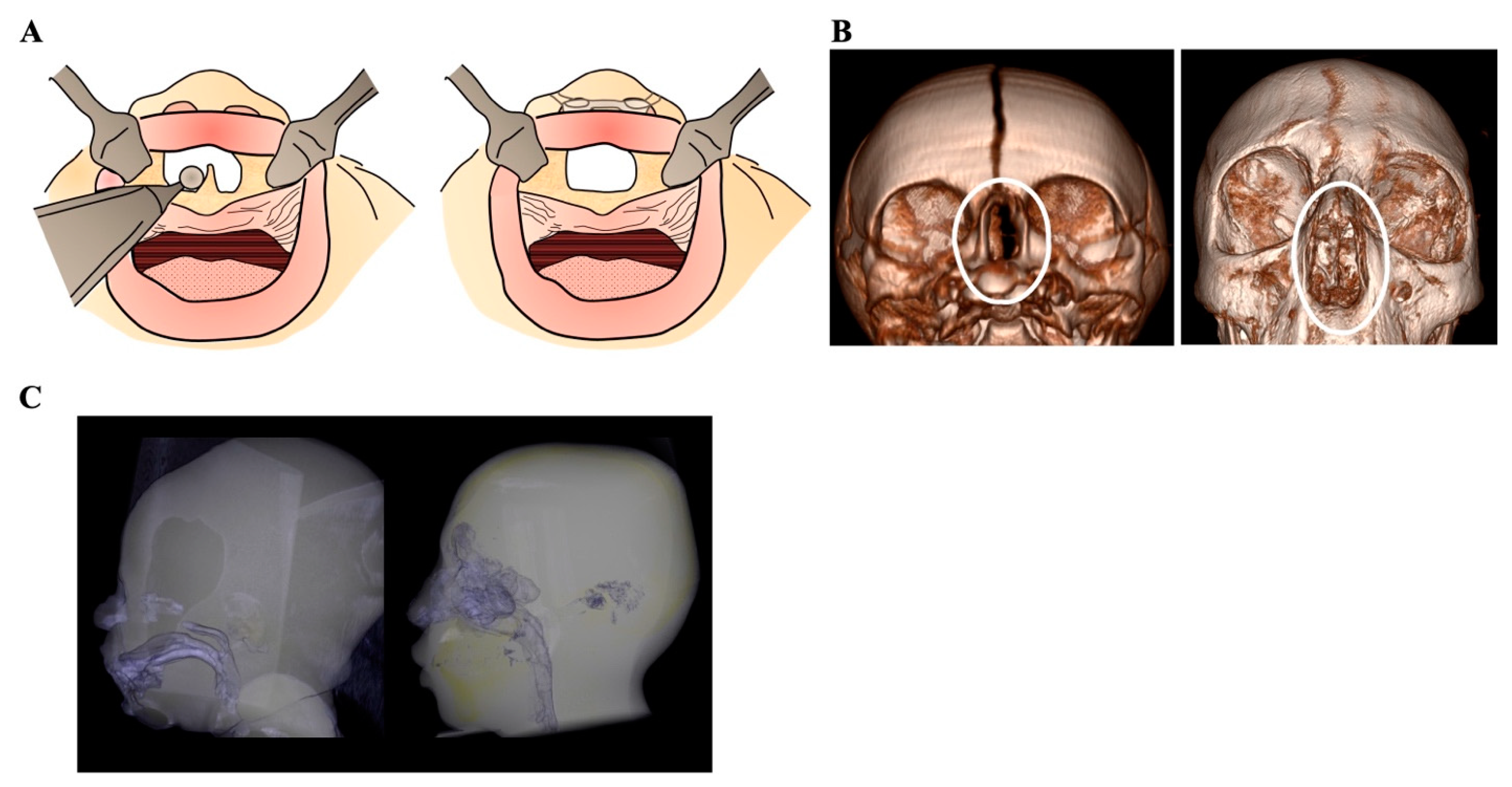 Children 12 00250 g005