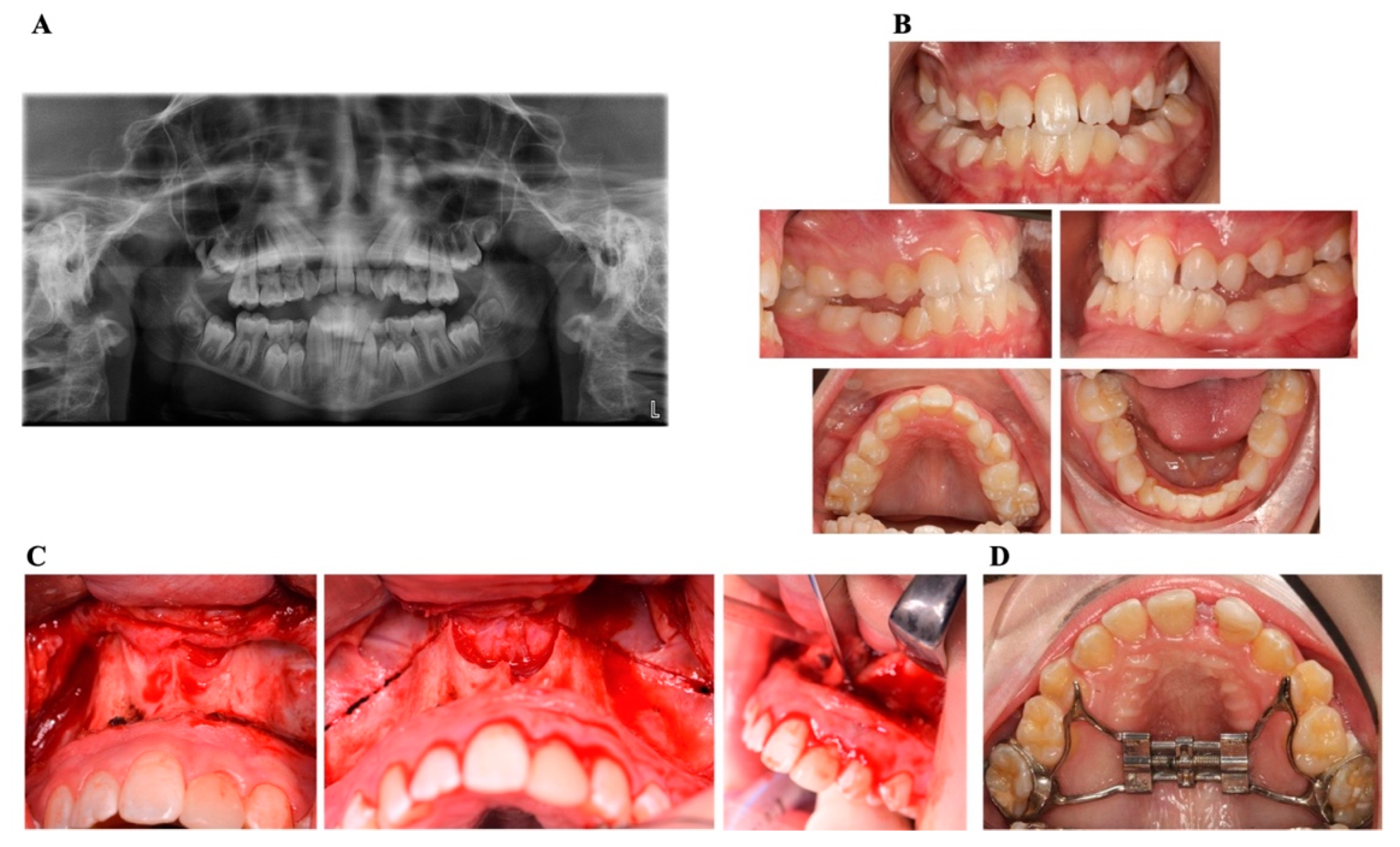 Children 12 00250 g006
