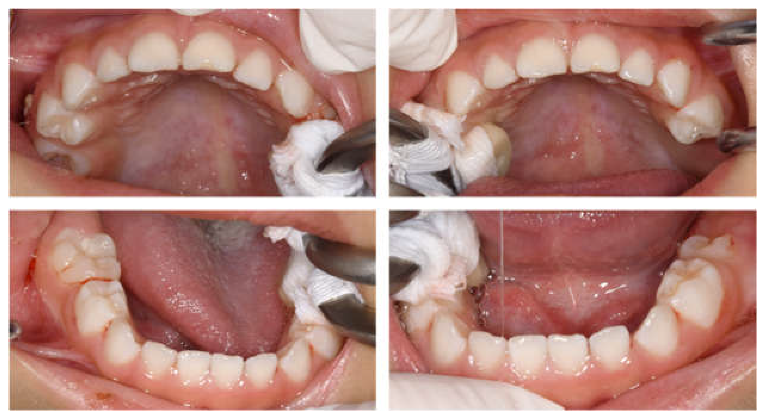 Children 12 00261 g001