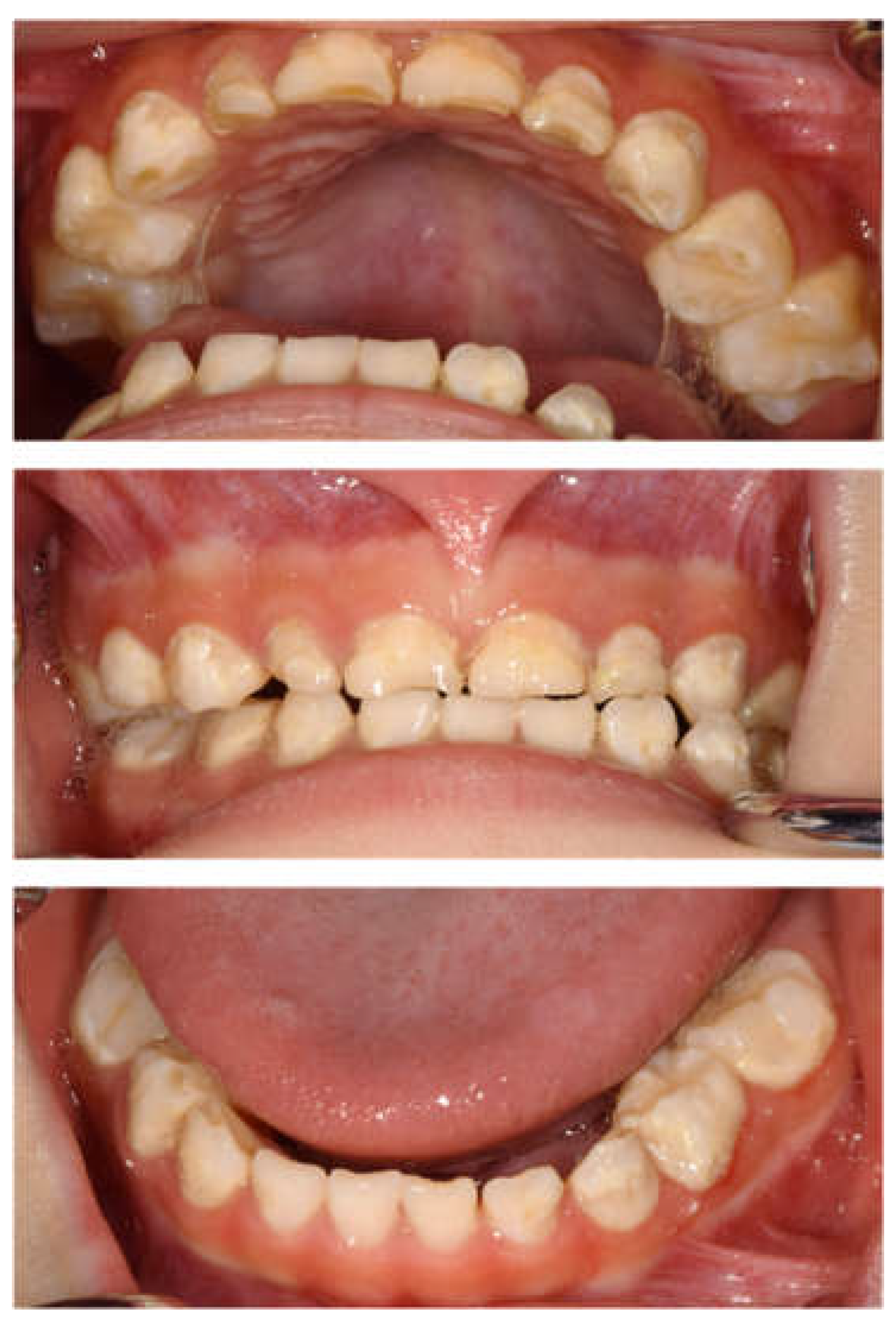 Children 12 00261 g002