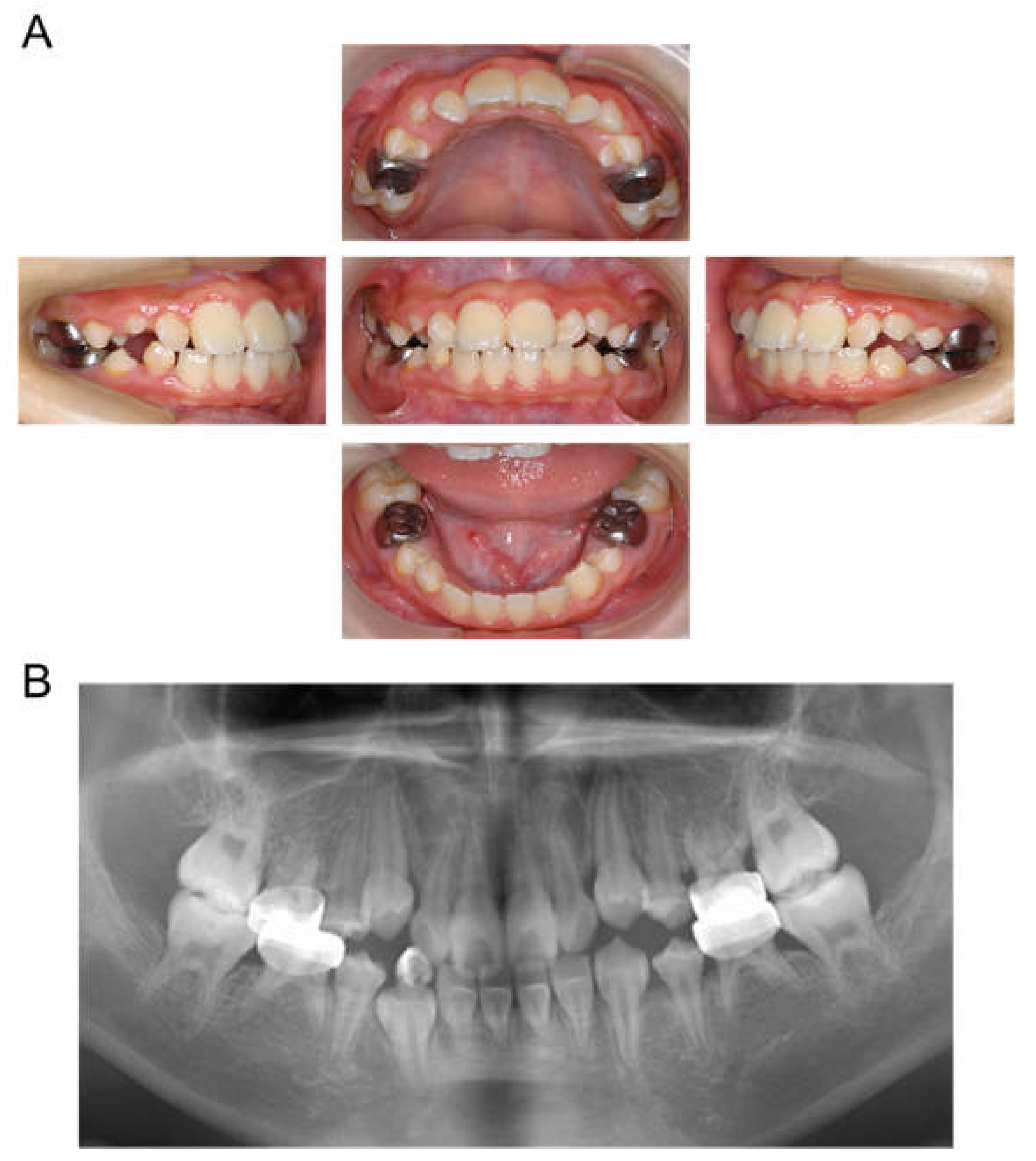 Children 12 00261 g005