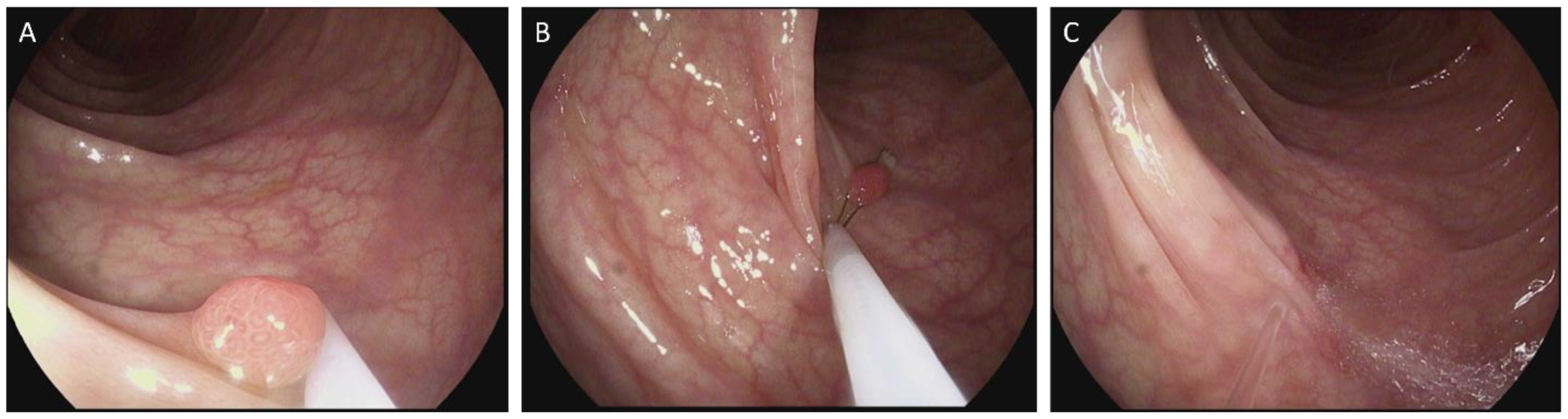 Children 12 00291 g001