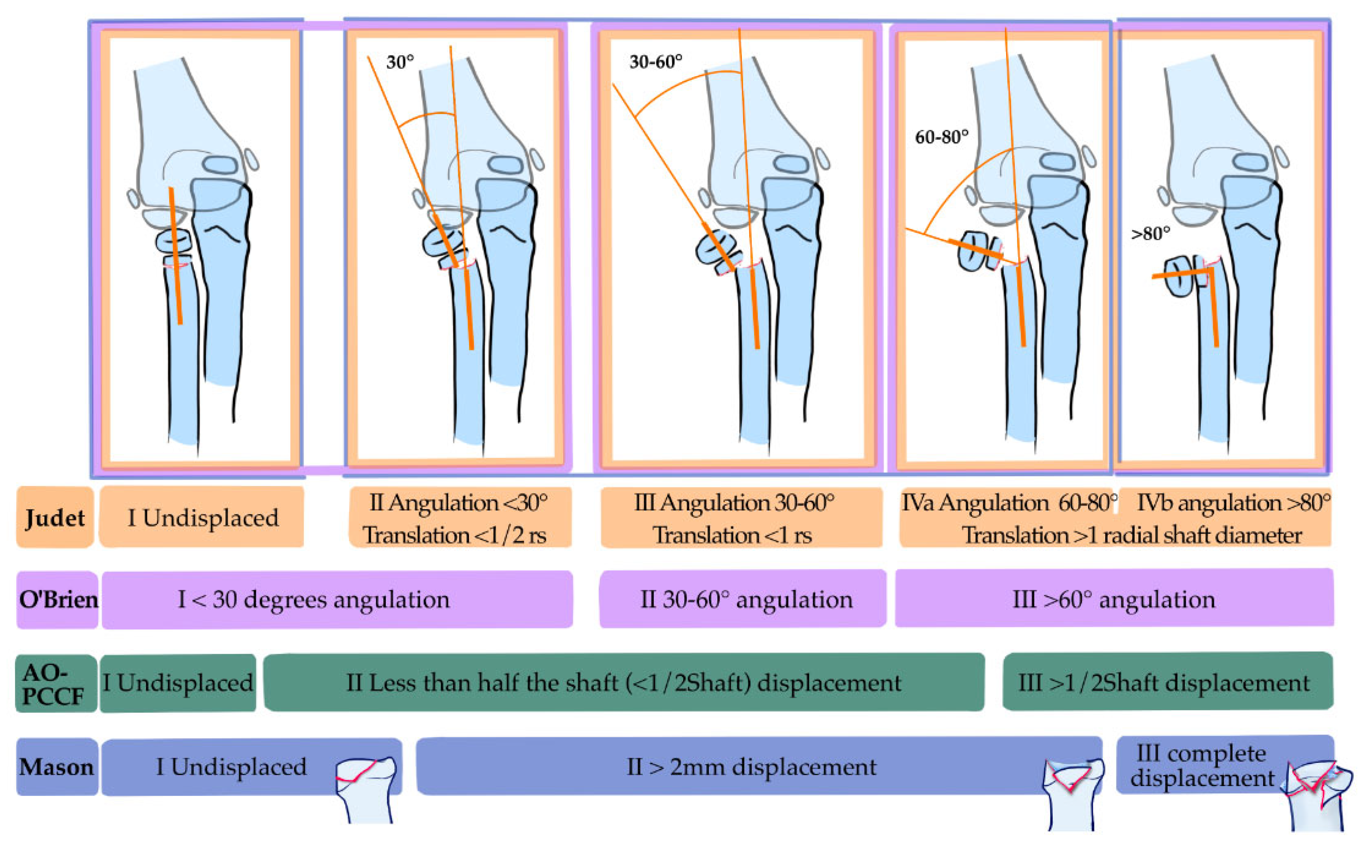 Children 12 00300 g005