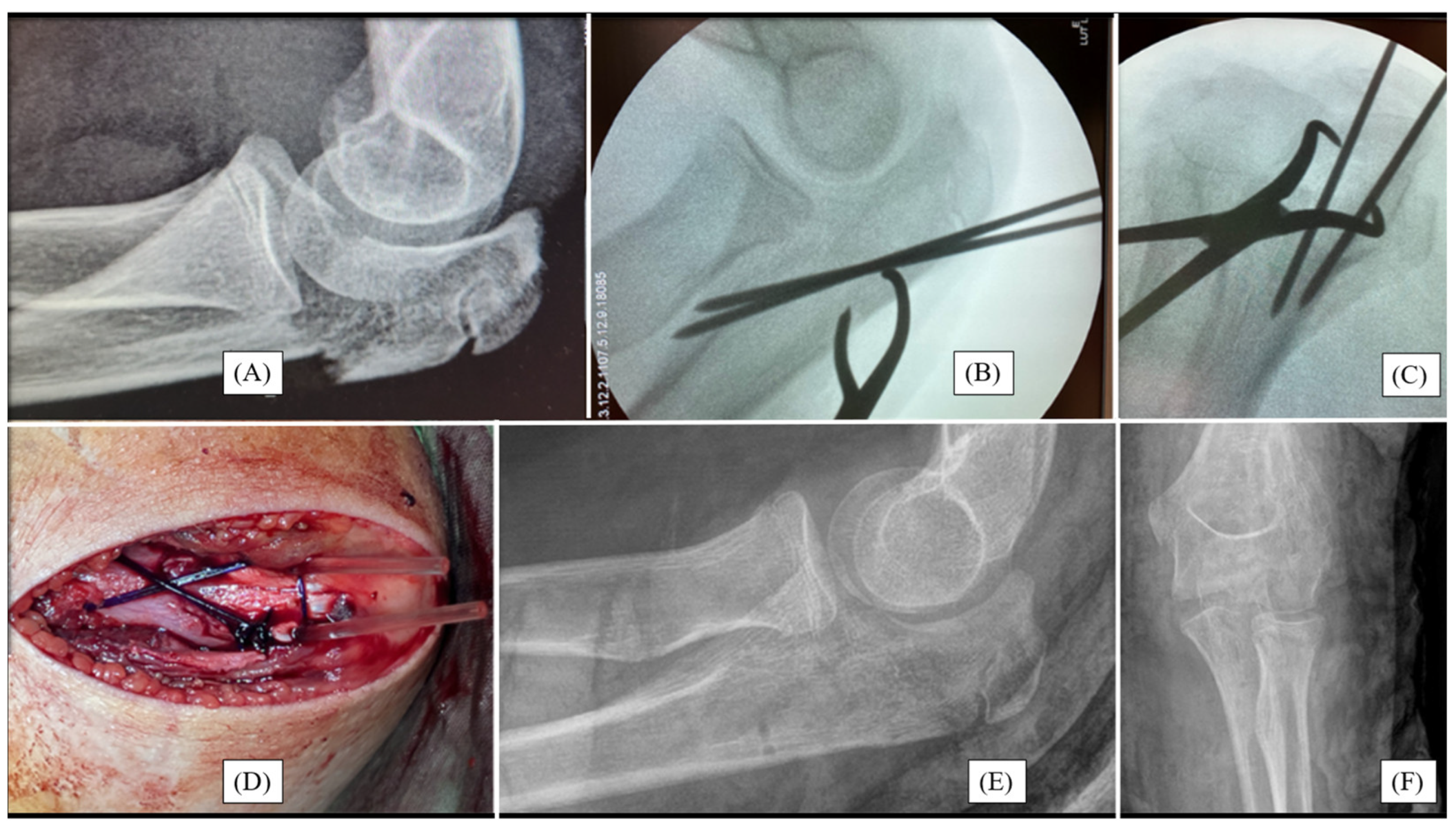 Children 12 00316 g001