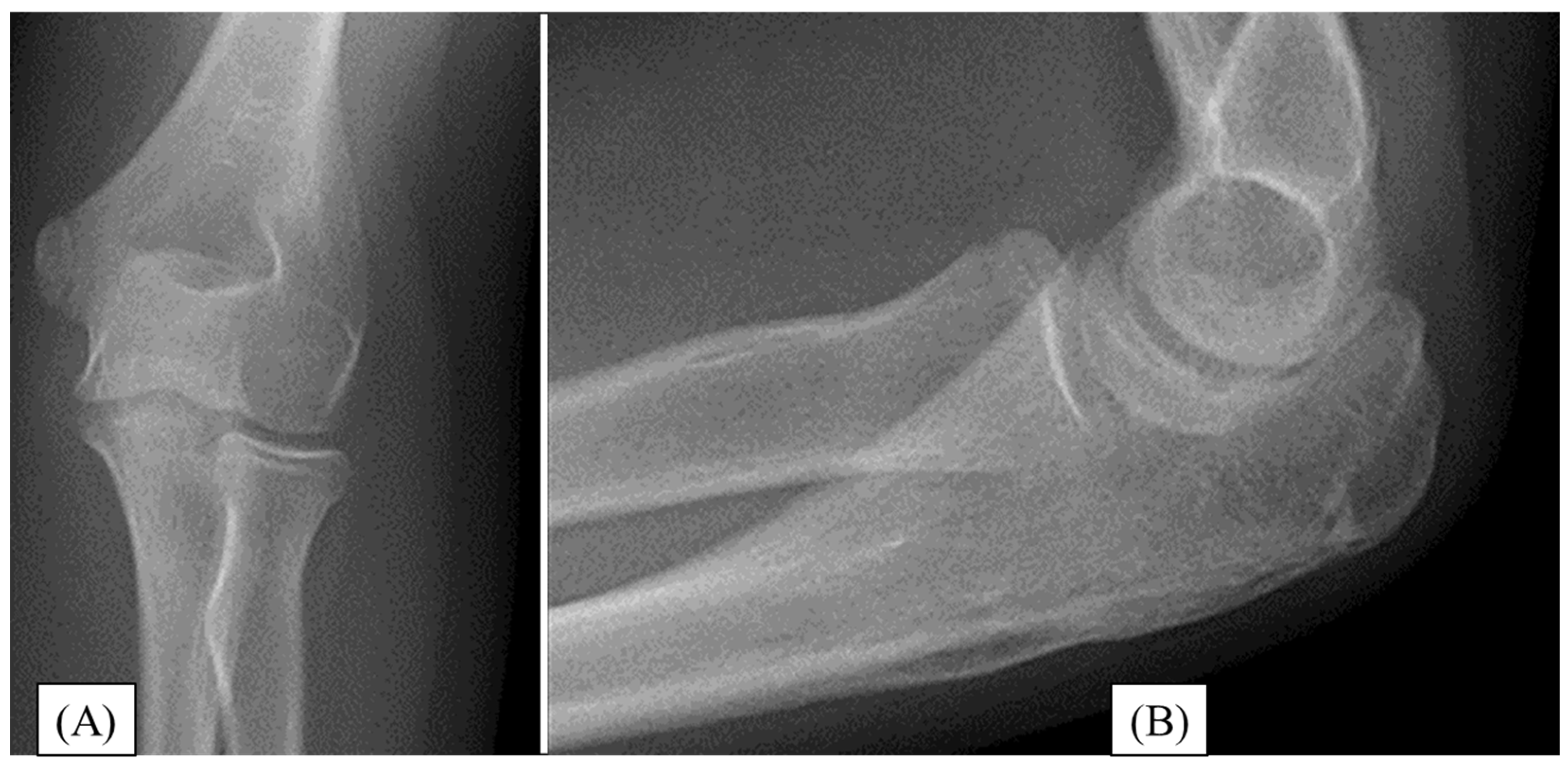 Children 12 00316 g002