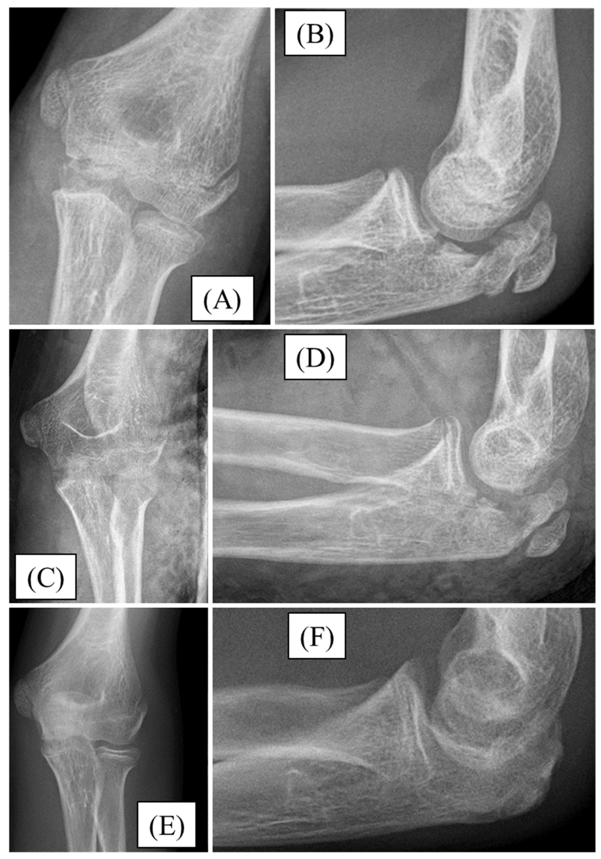 Children 12 00316 g003