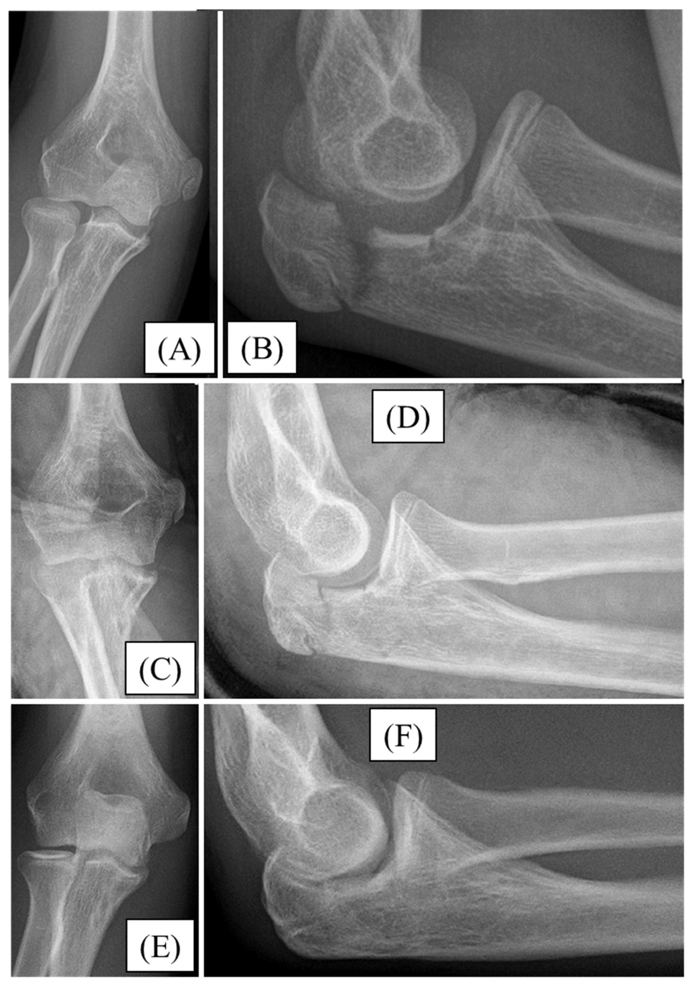 Children 12 00316 g004