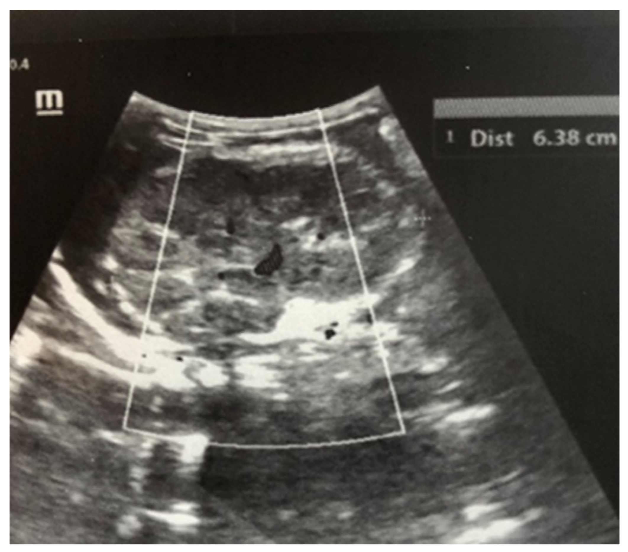 Children 12 00319 g001