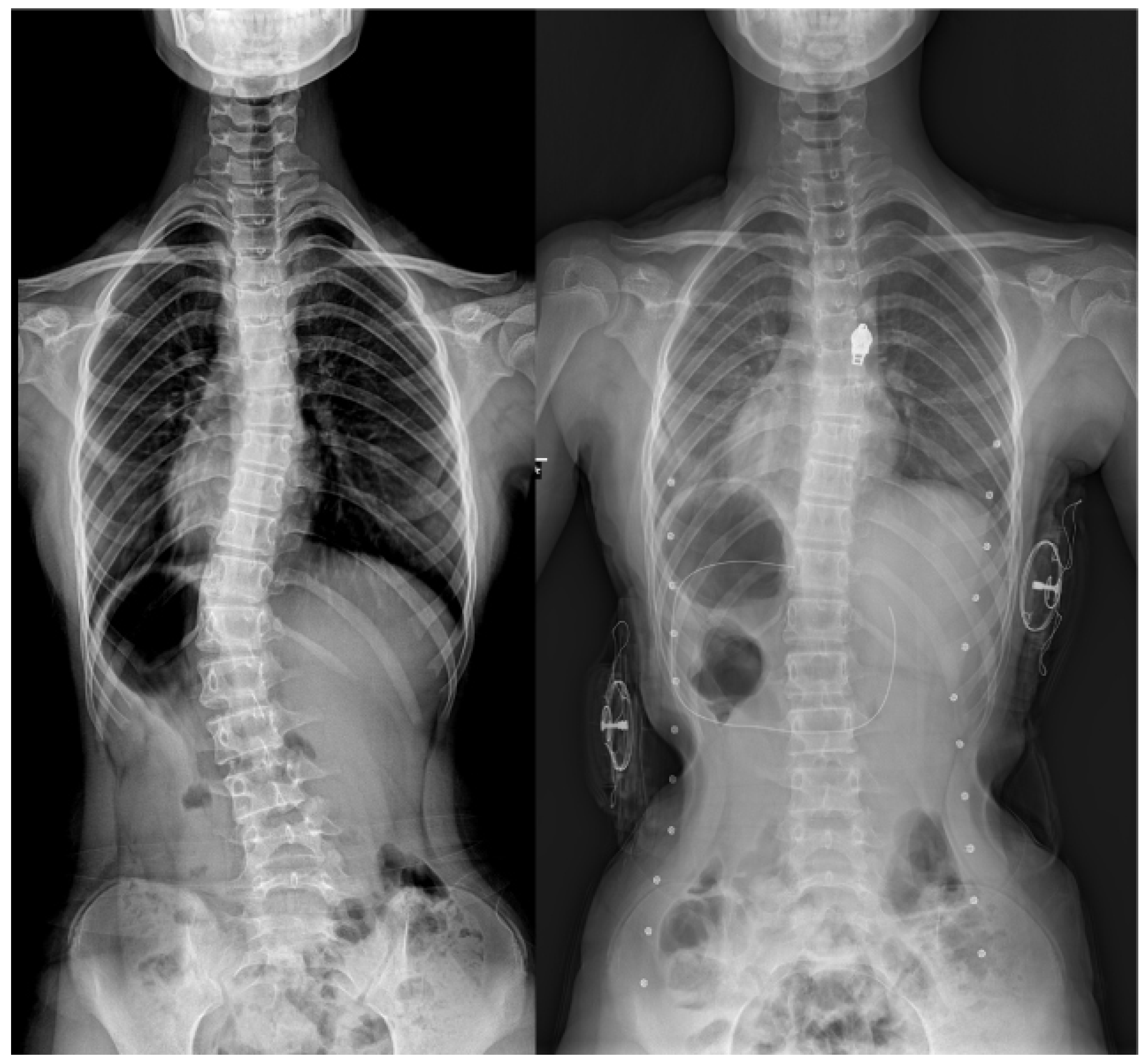 Children 12 00328 g002