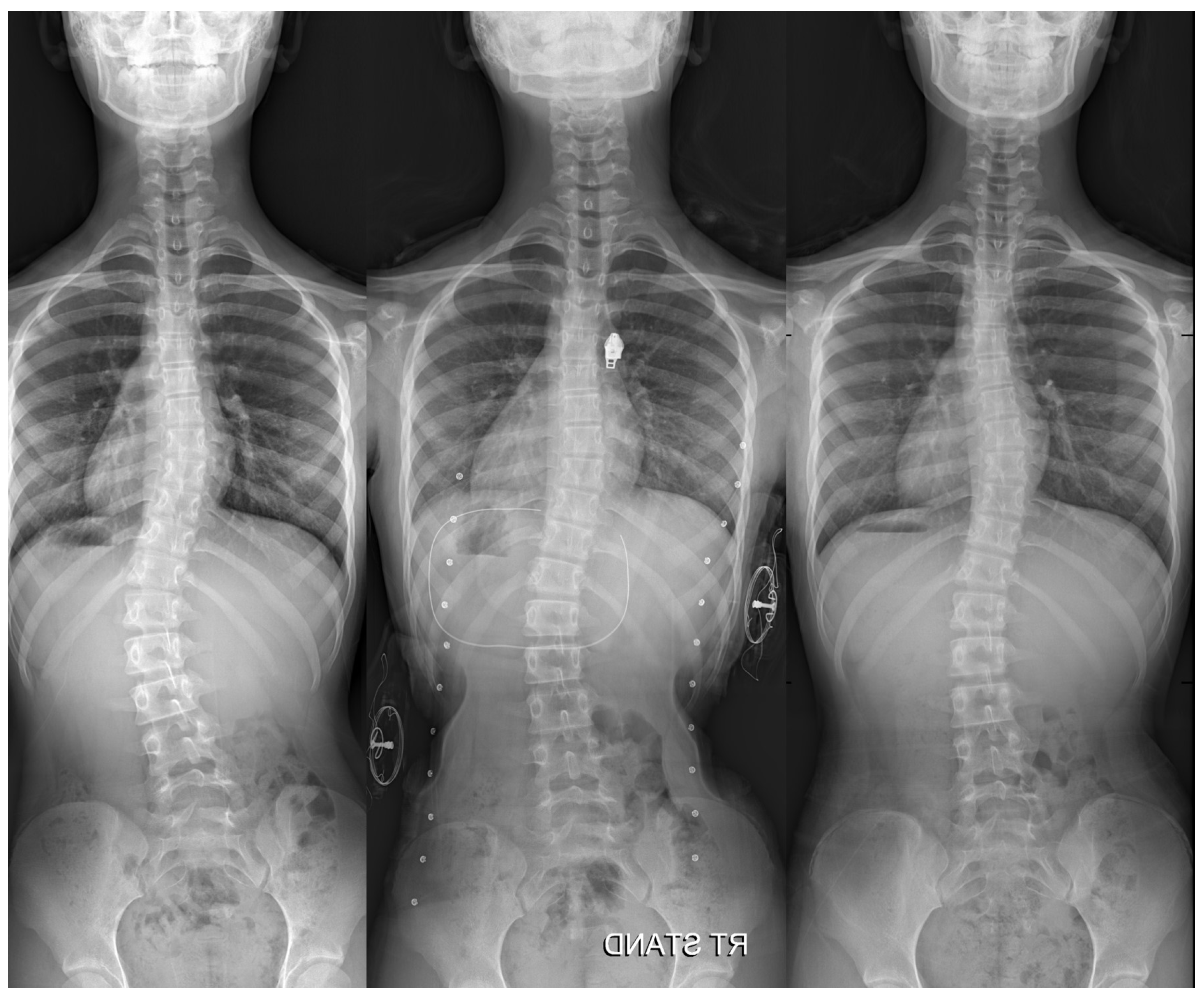 Children 12 00328 g003