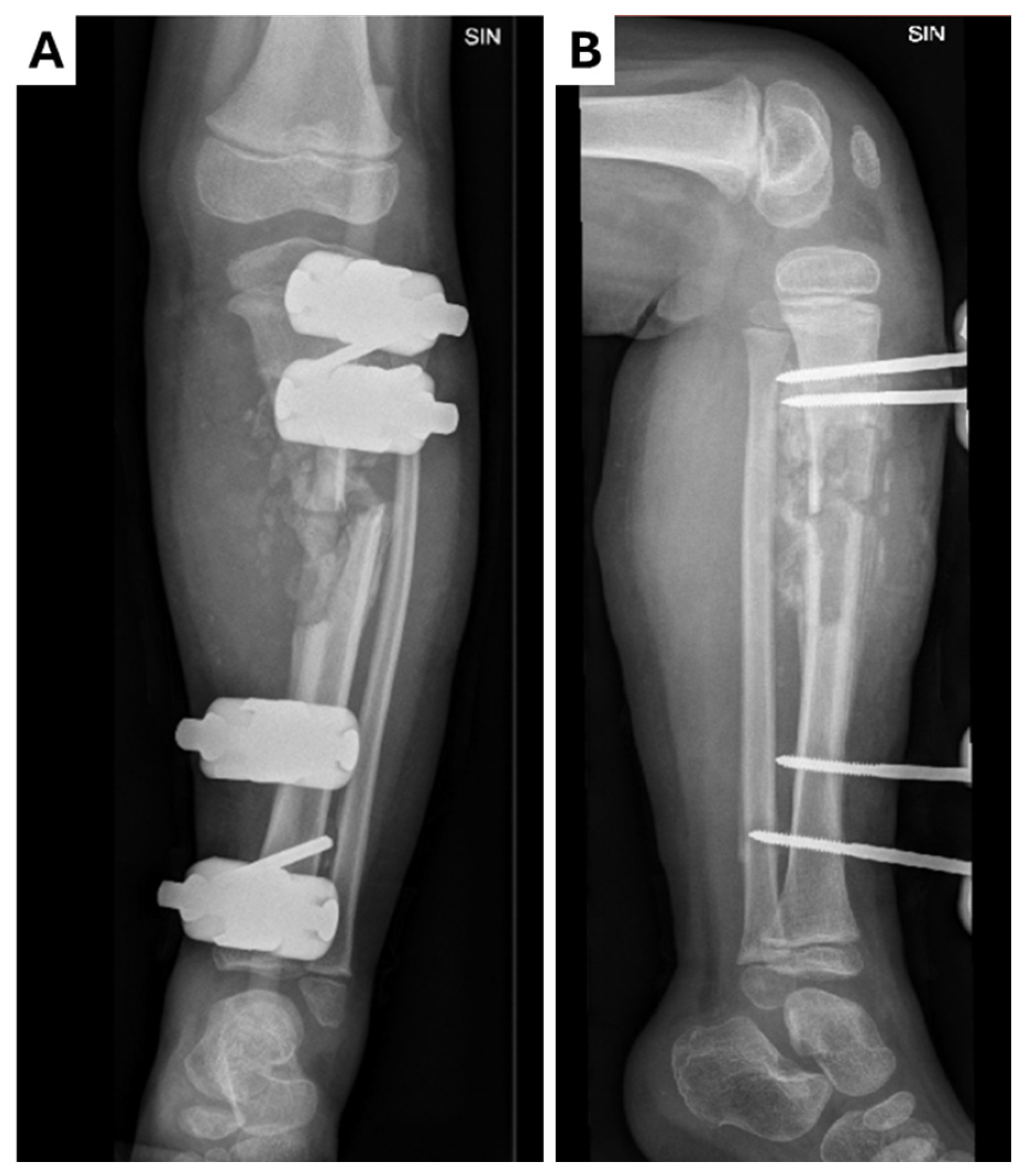 Children 12 00344 g002 Children 12 00344 g002