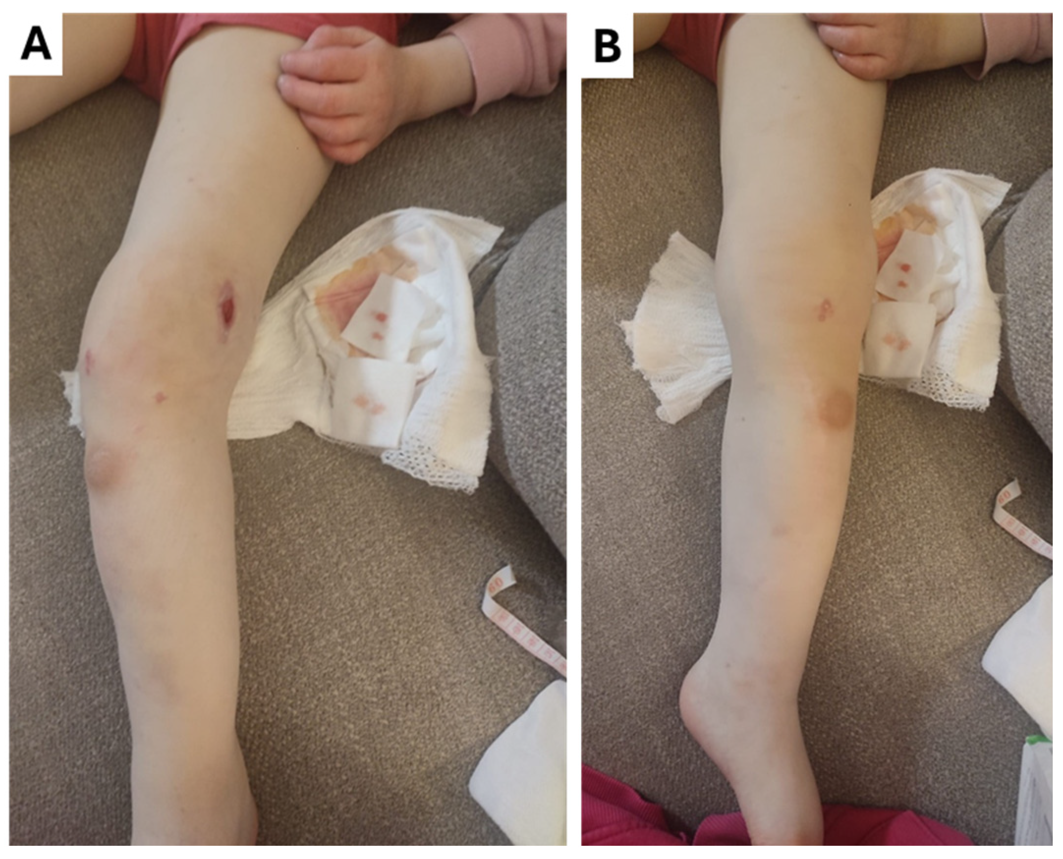 Children 12 00344 g005 Children 12 00344 g005