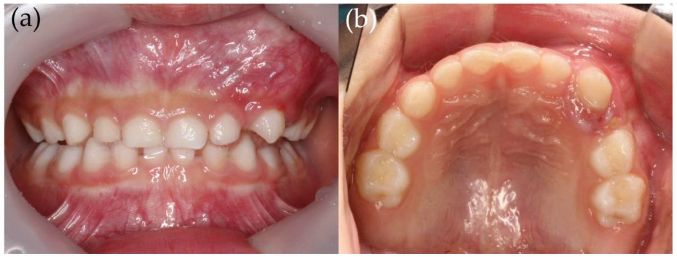 Children 12 00379 g001