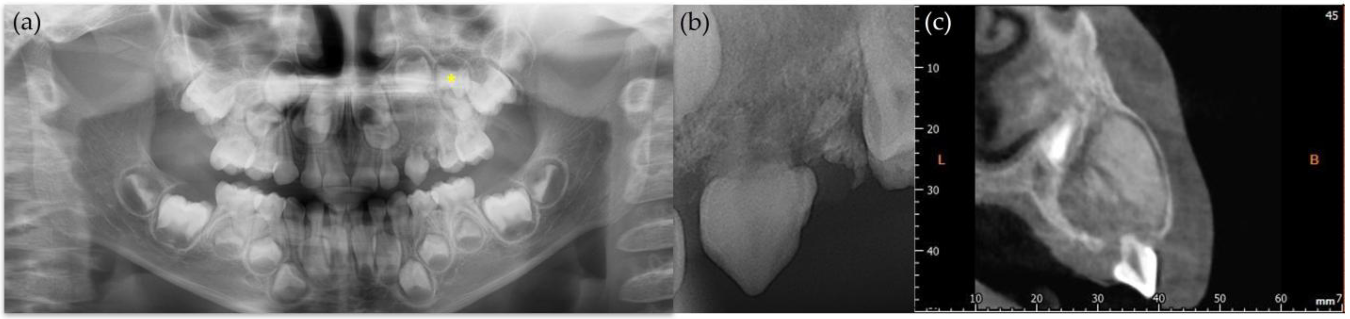 Children 12 00379 g002