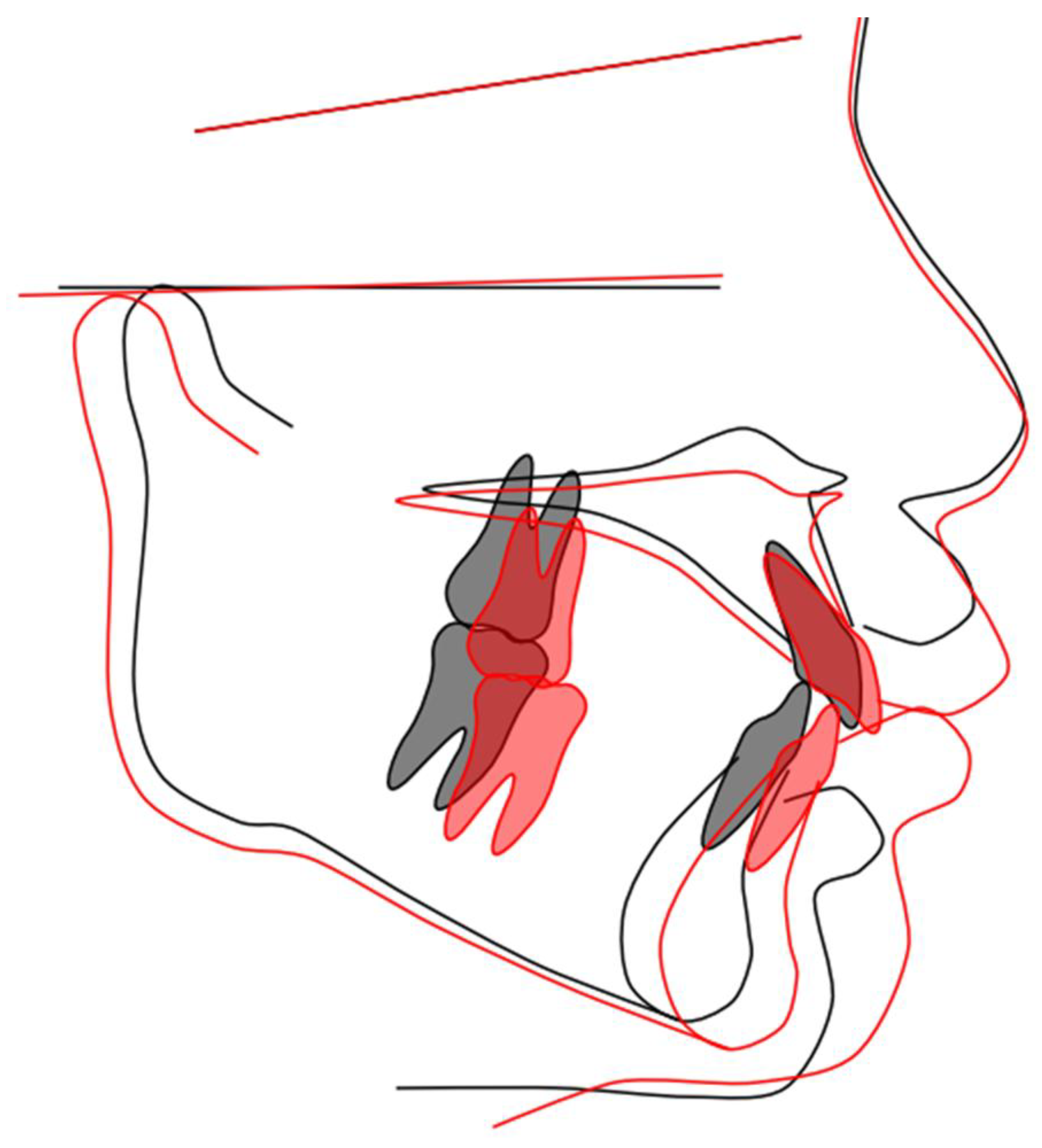 Children 12 00379 g004