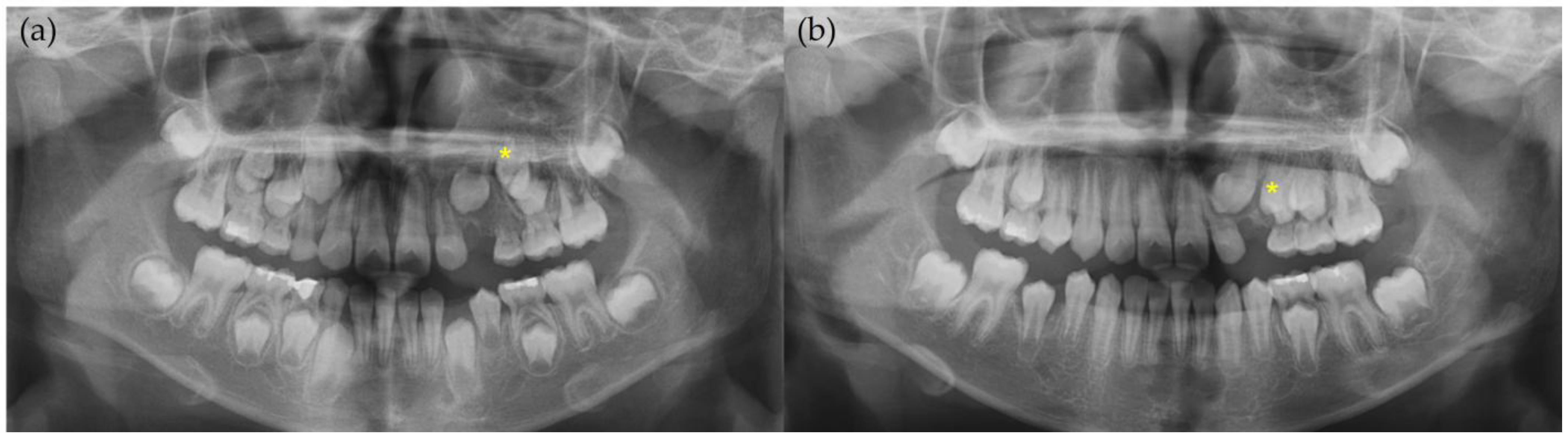 Children 12 00379 g005