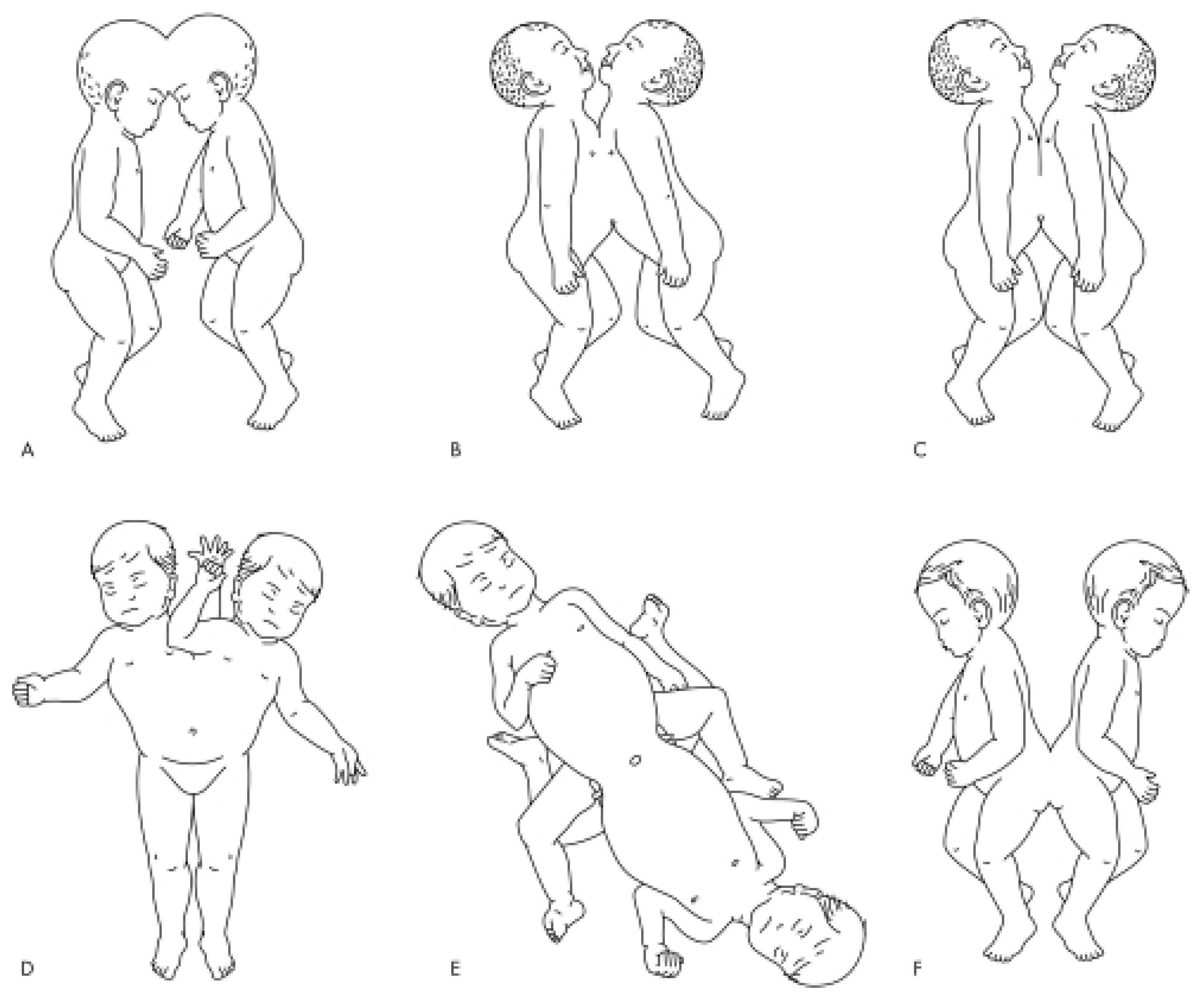 Children 12 00423 g004