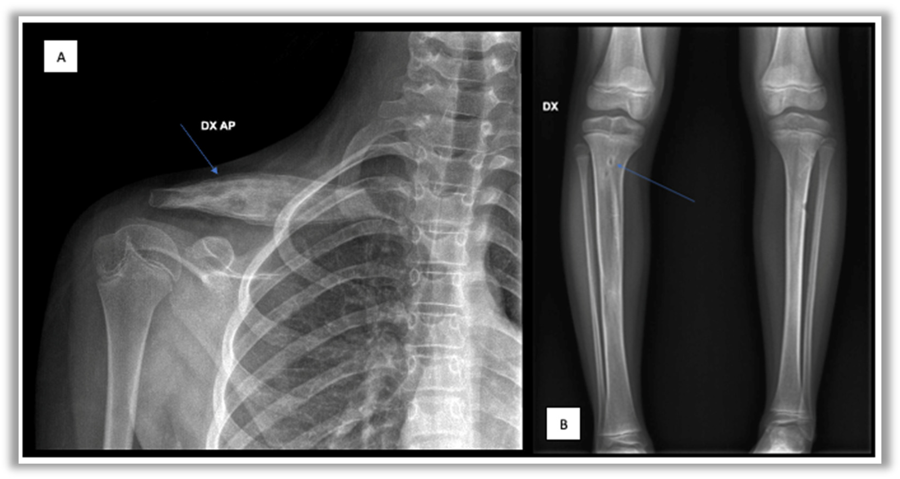 Children 12 00451 g001