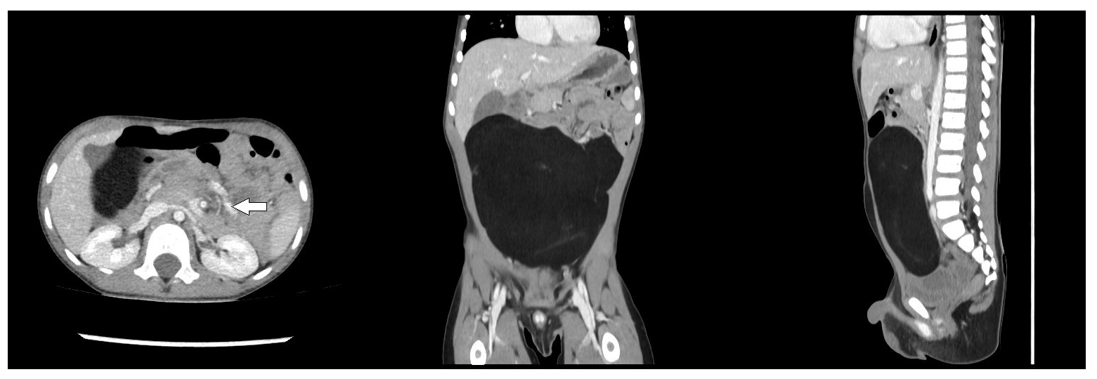 Children 12 00461 g001