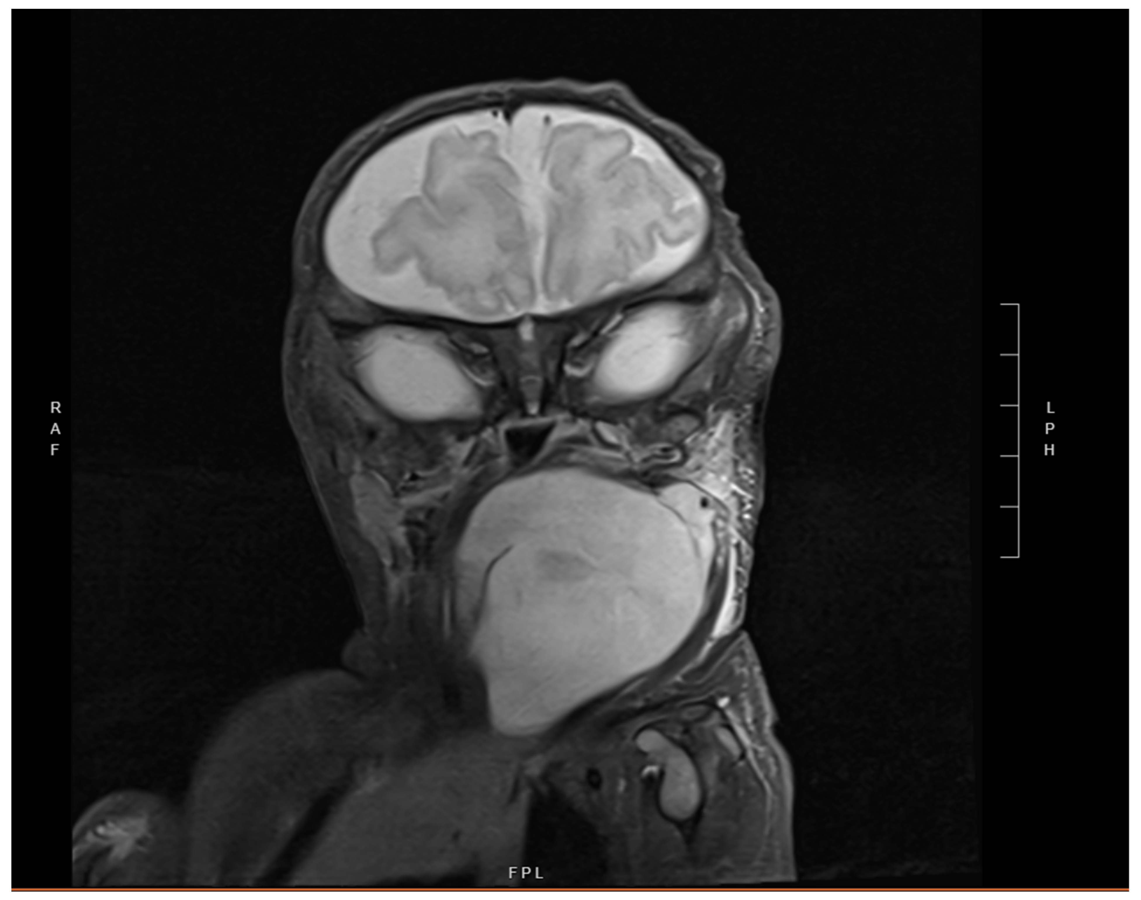 Children 12 00480 g002