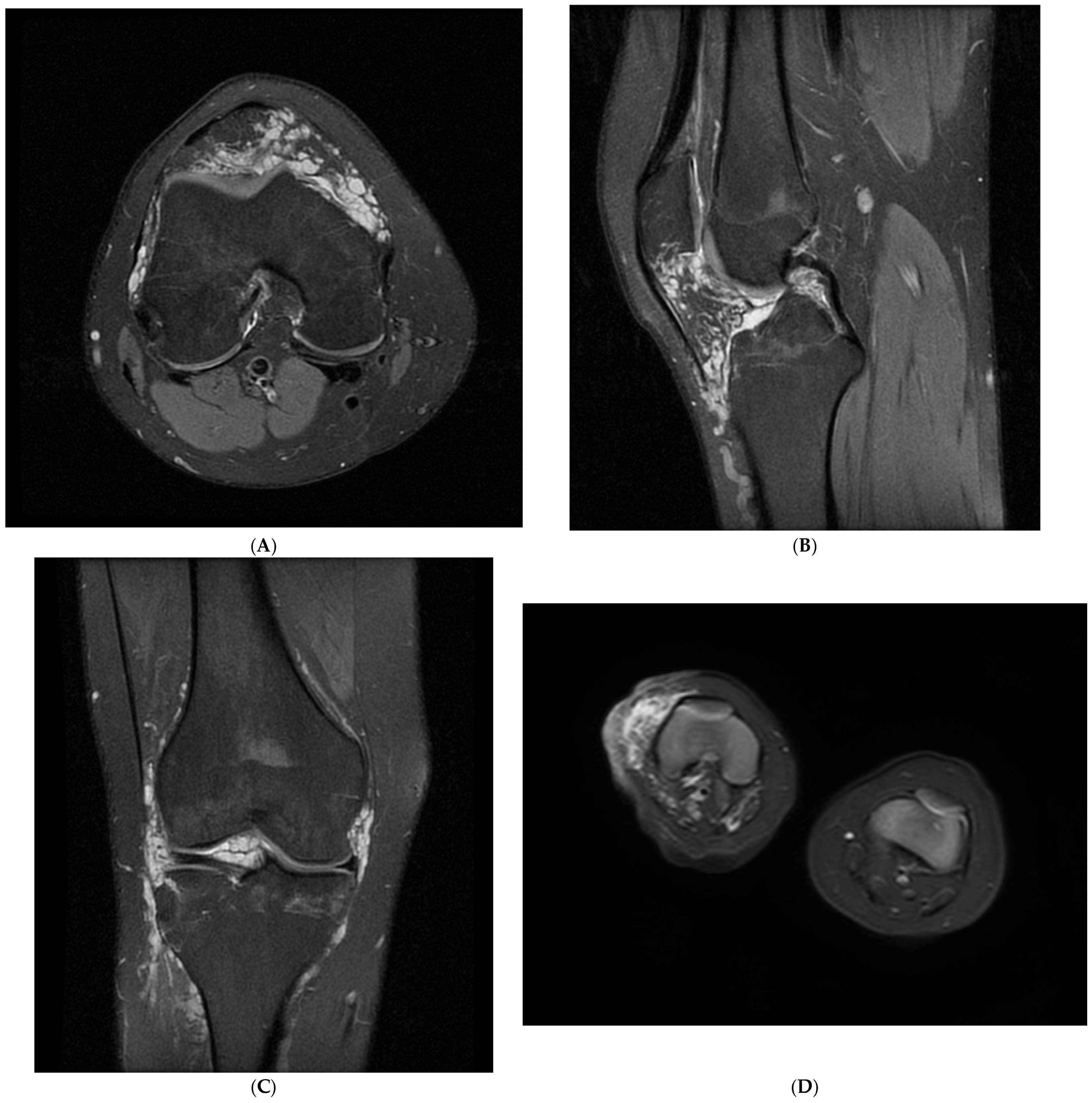 Children 12 00514 g001a