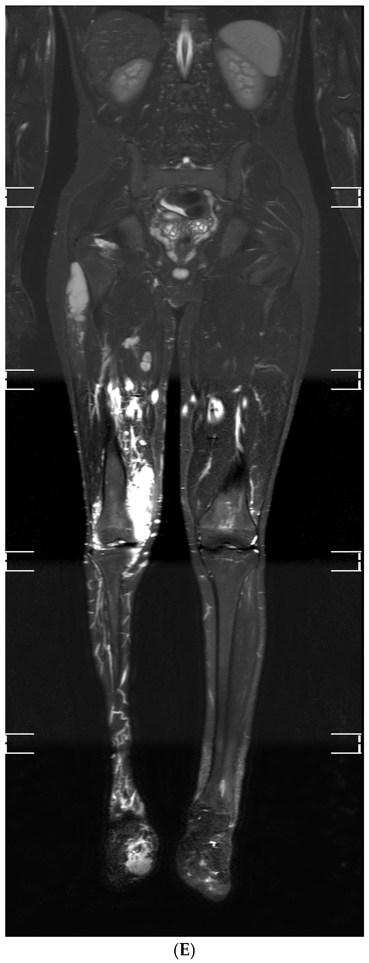 Children 12 00514 g001b