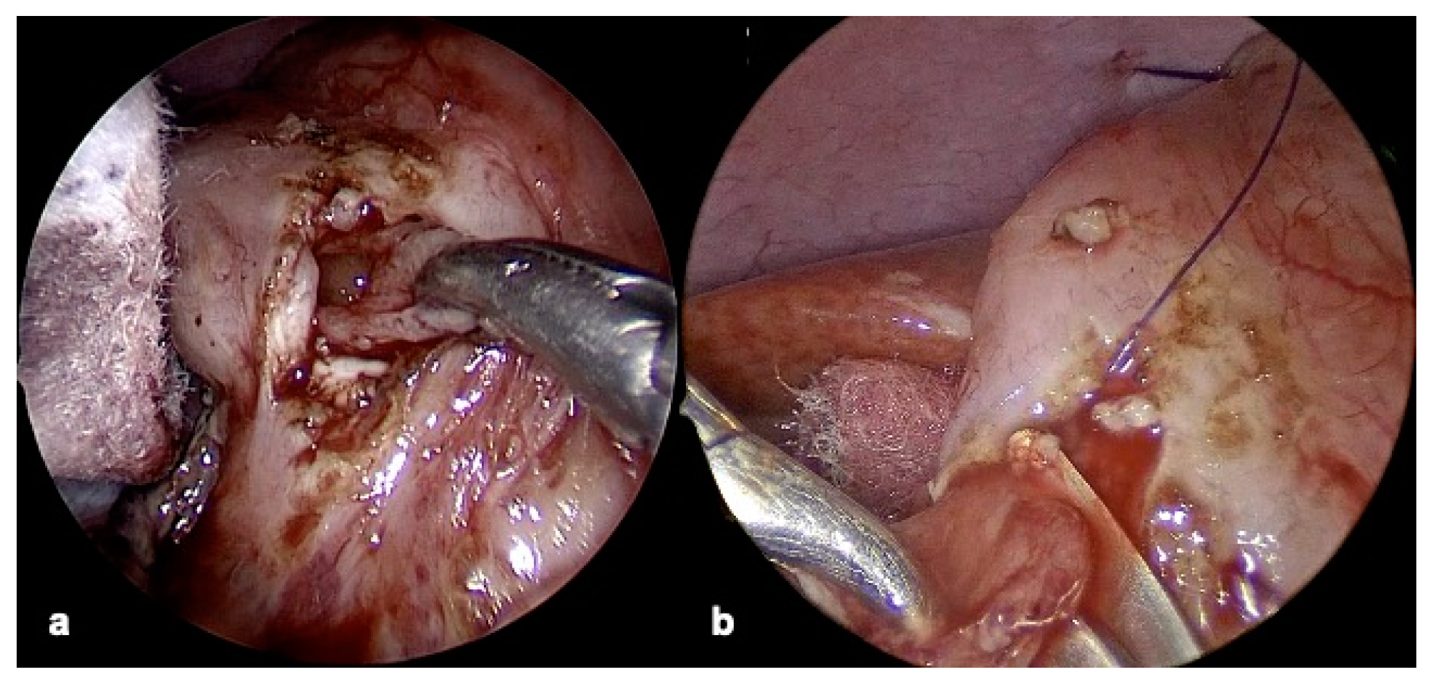 Children 12 00517 g006