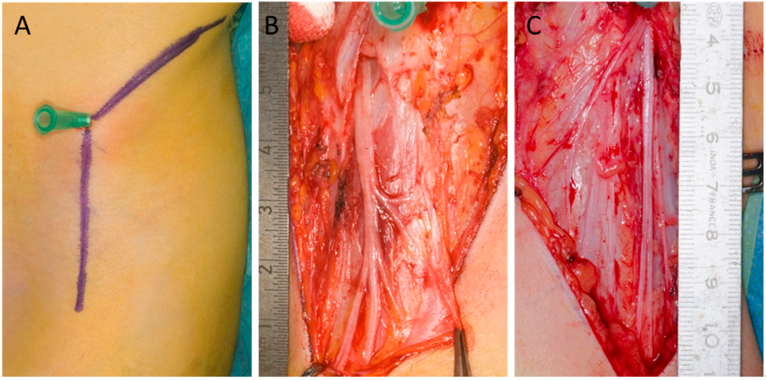 Children 12 00521 g001