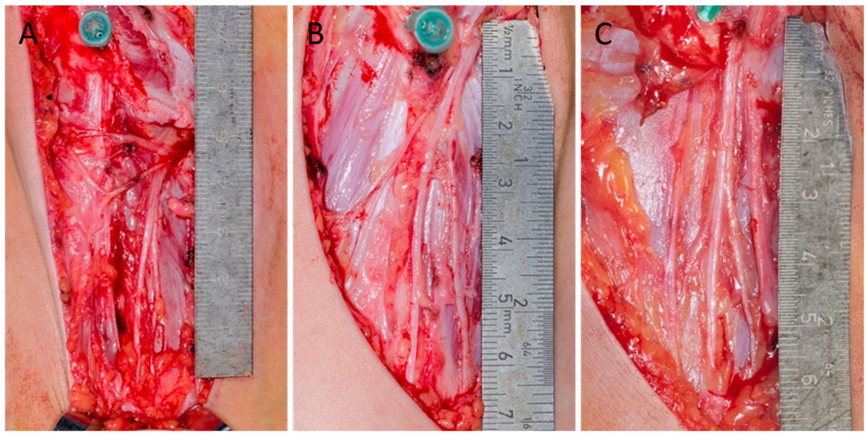 Children 12 00521 g002