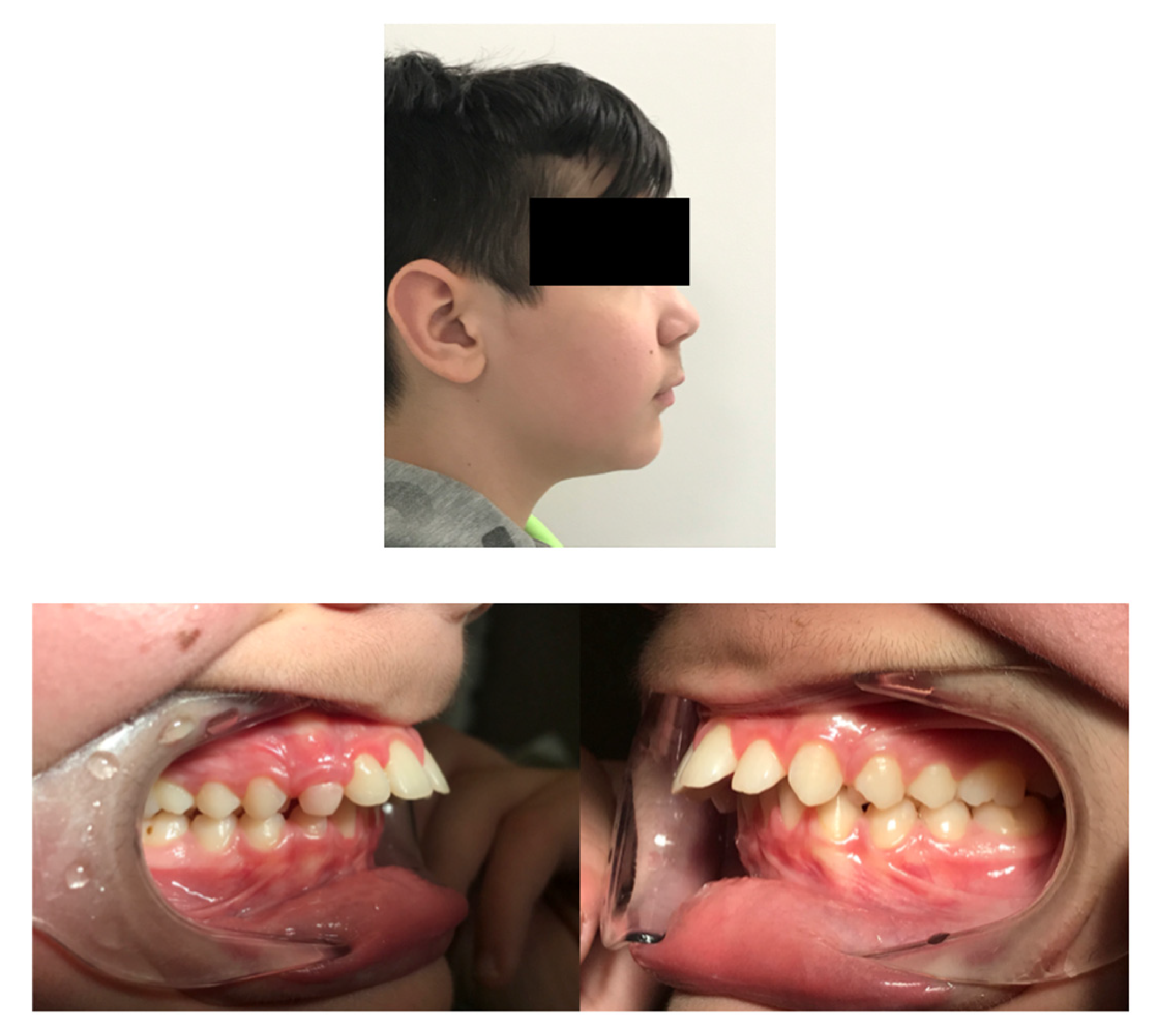 Children 12 00531 g002 Children 12 00531 g002