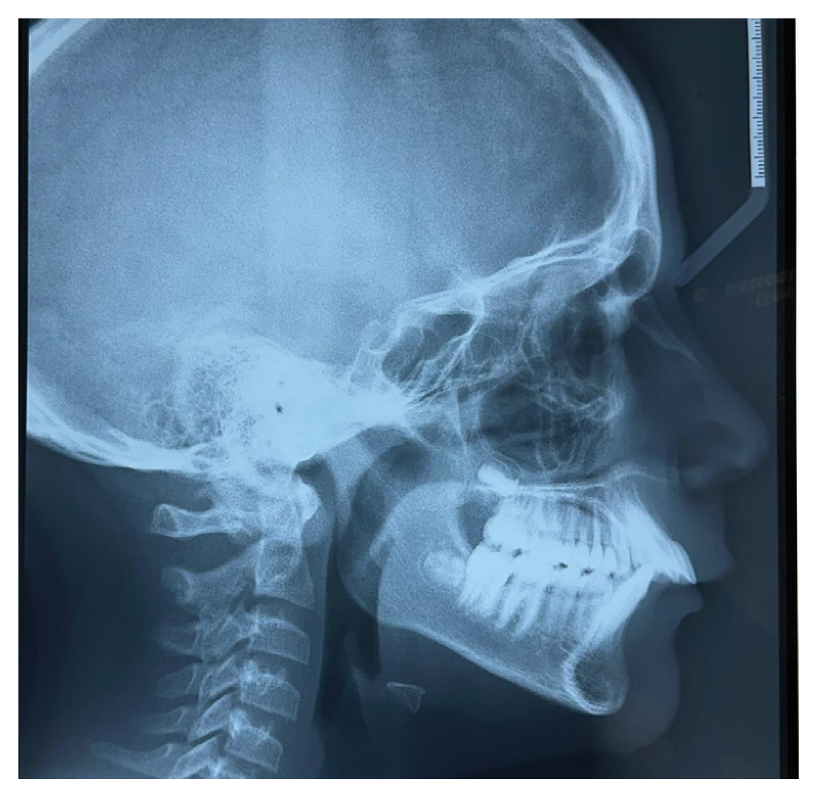 Children 12 00531 g004 Children 12 00531 g004