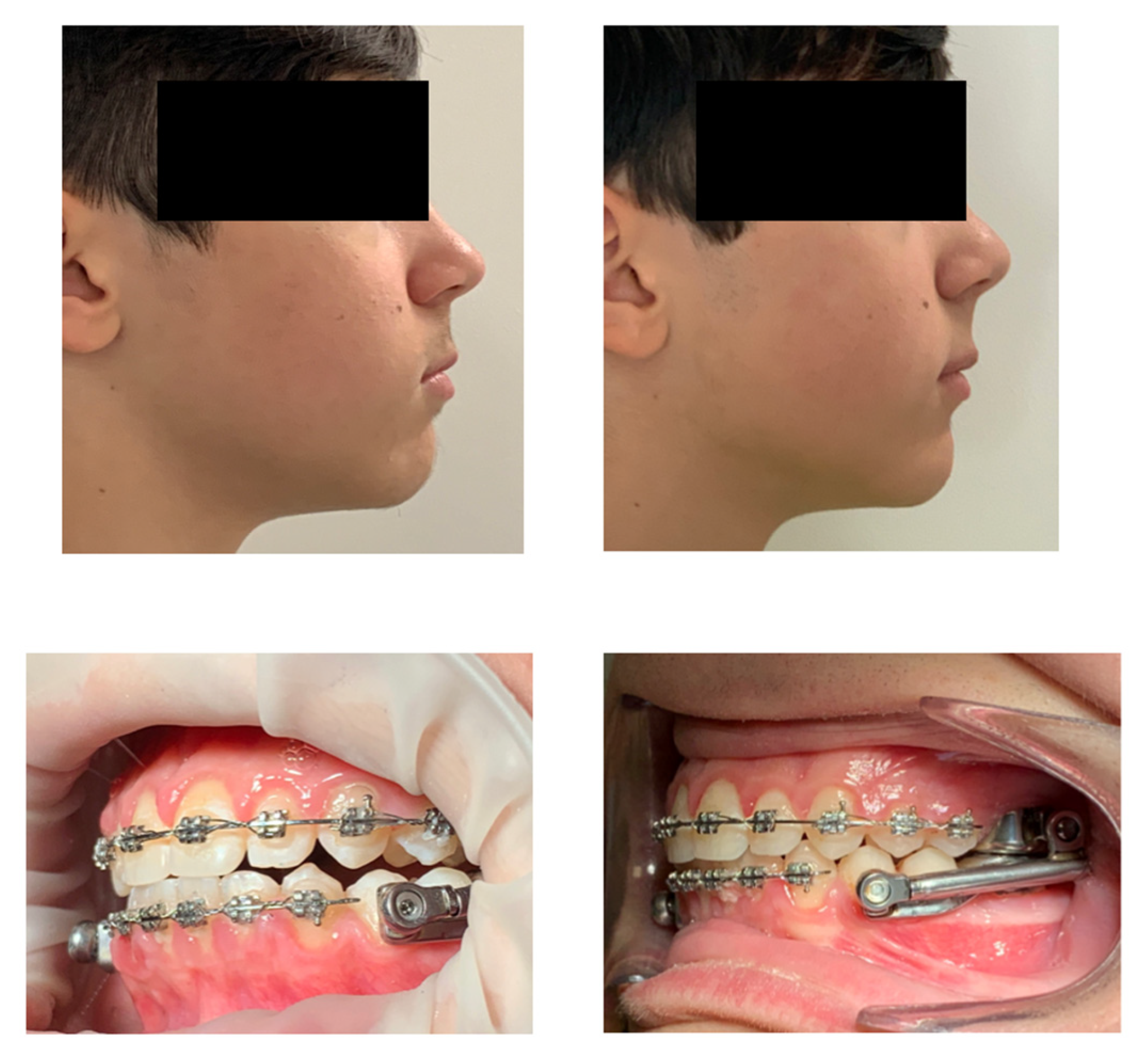 Children 12 00531 g007 Children 12 00531 g007