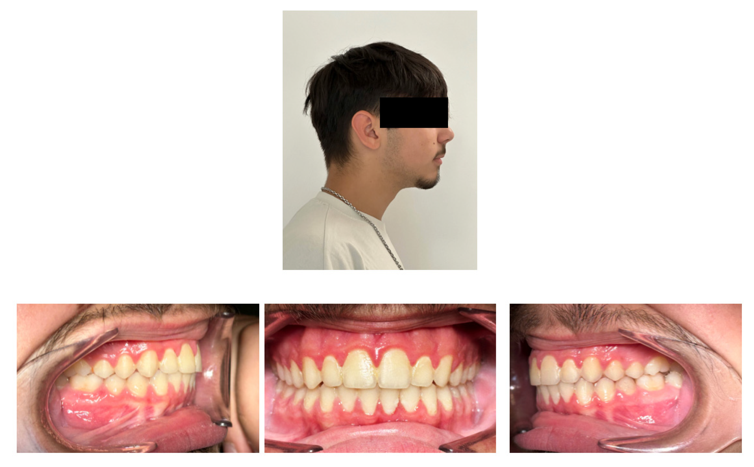 Children 12 00531 g008 Children 12 00531 g008