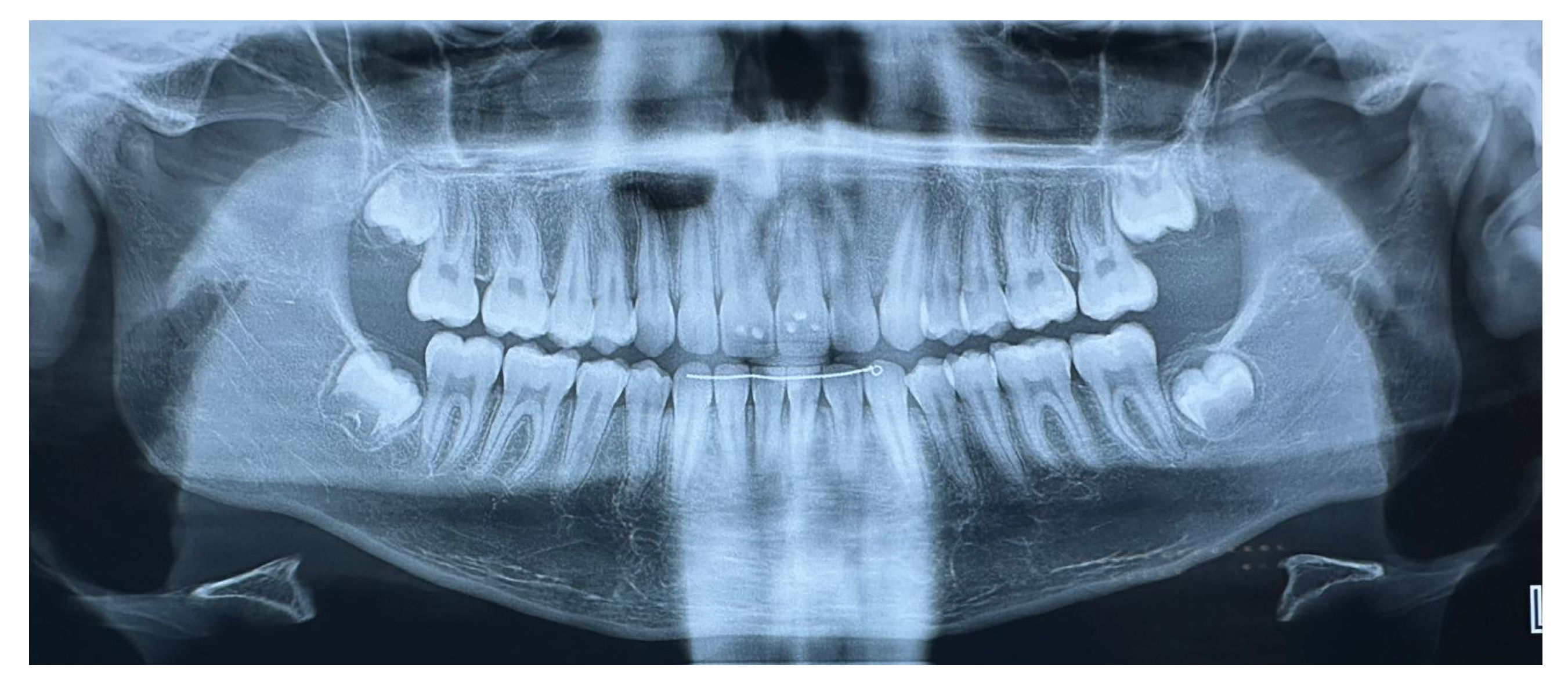 Children 12 00531 g009 Children 12 00531 g009