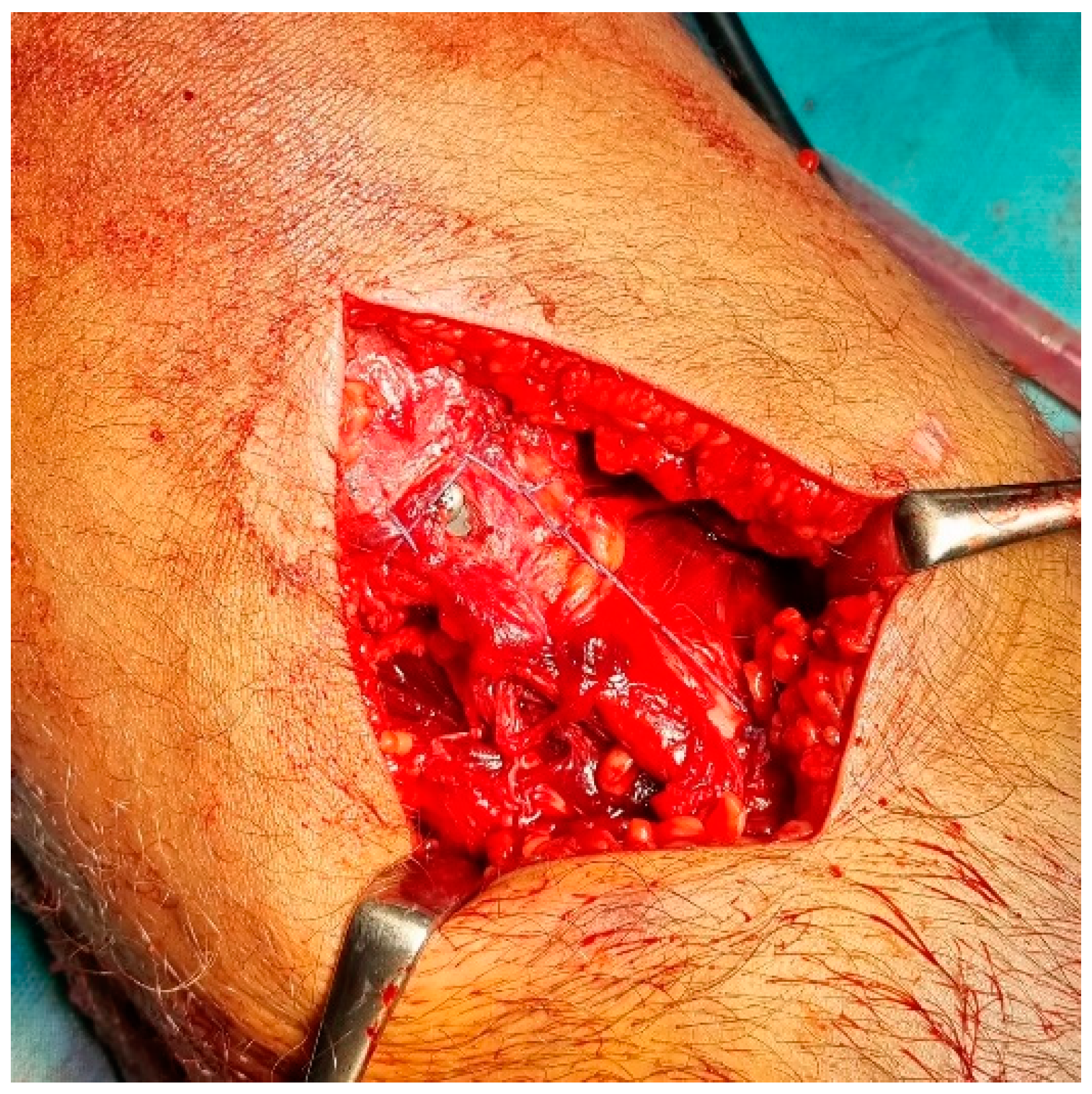 Children 12 00533 g003