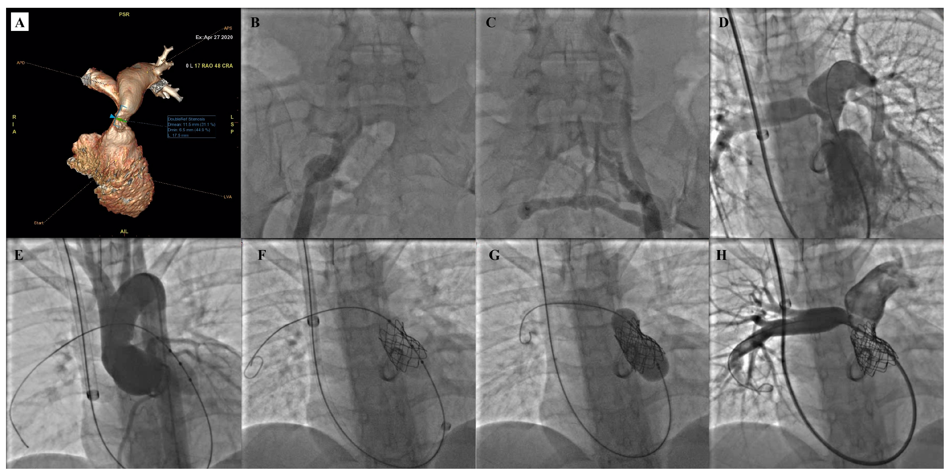 Children 12 00547 g003