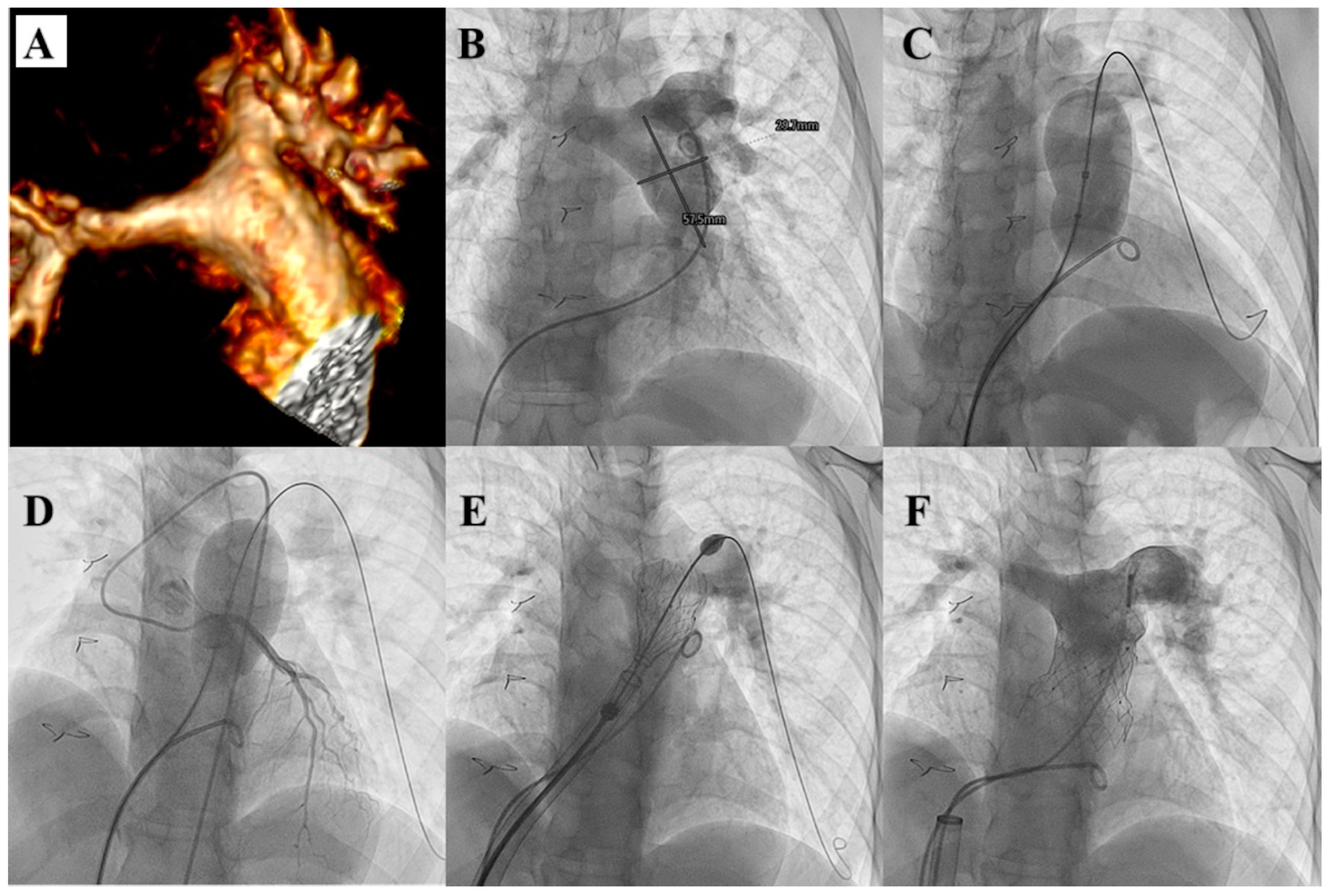 Children 12 00547 g005
