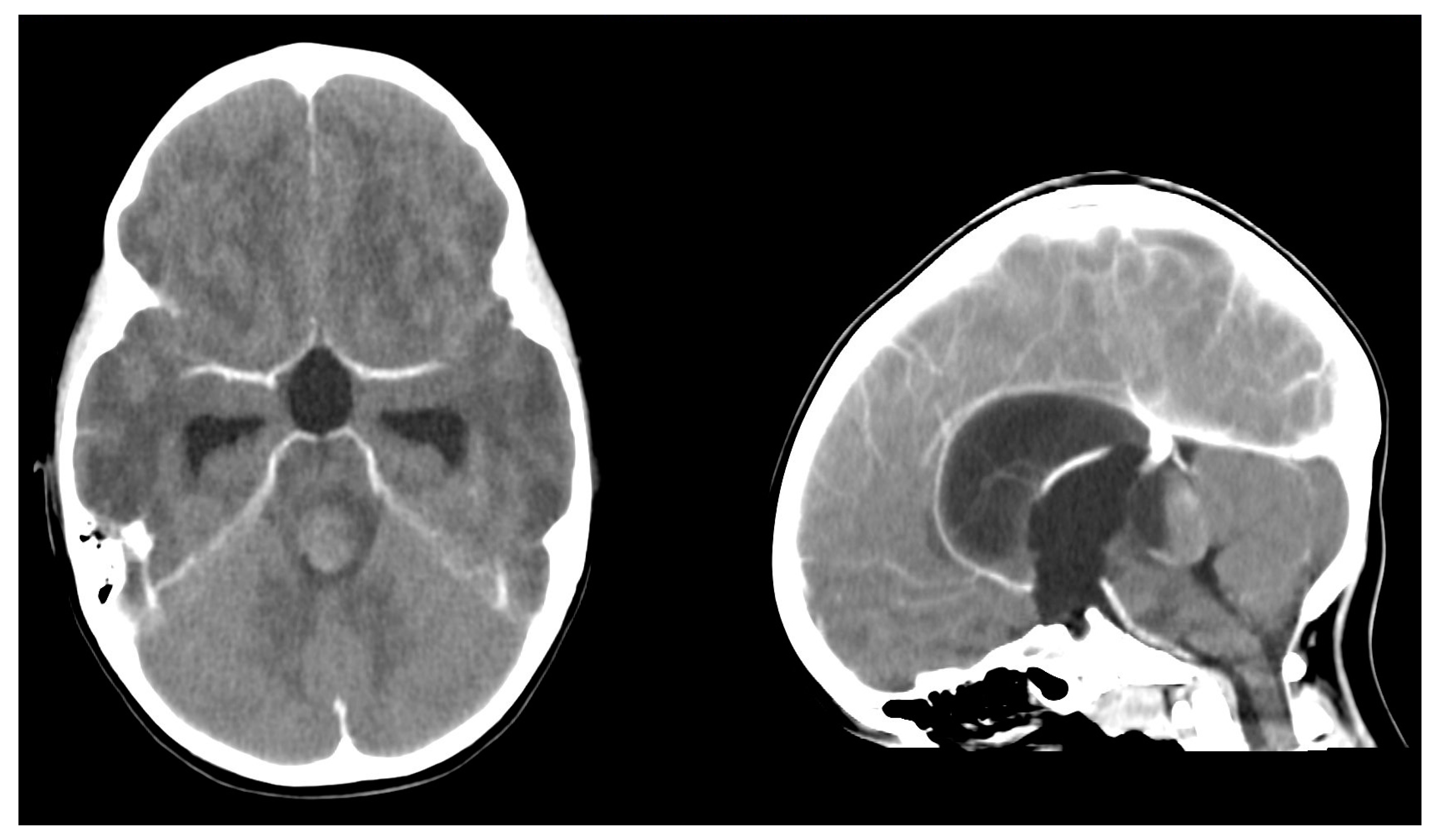 Children 12 00564 g001