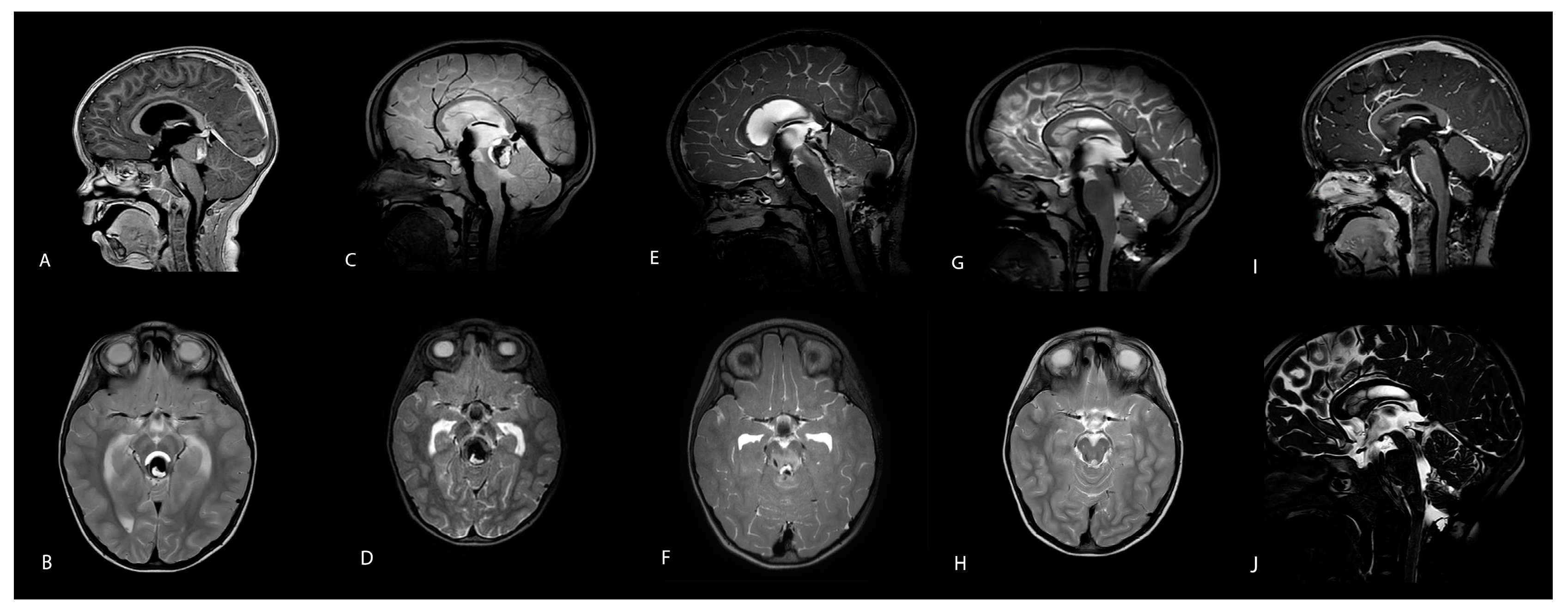 Children 12 00564 g002