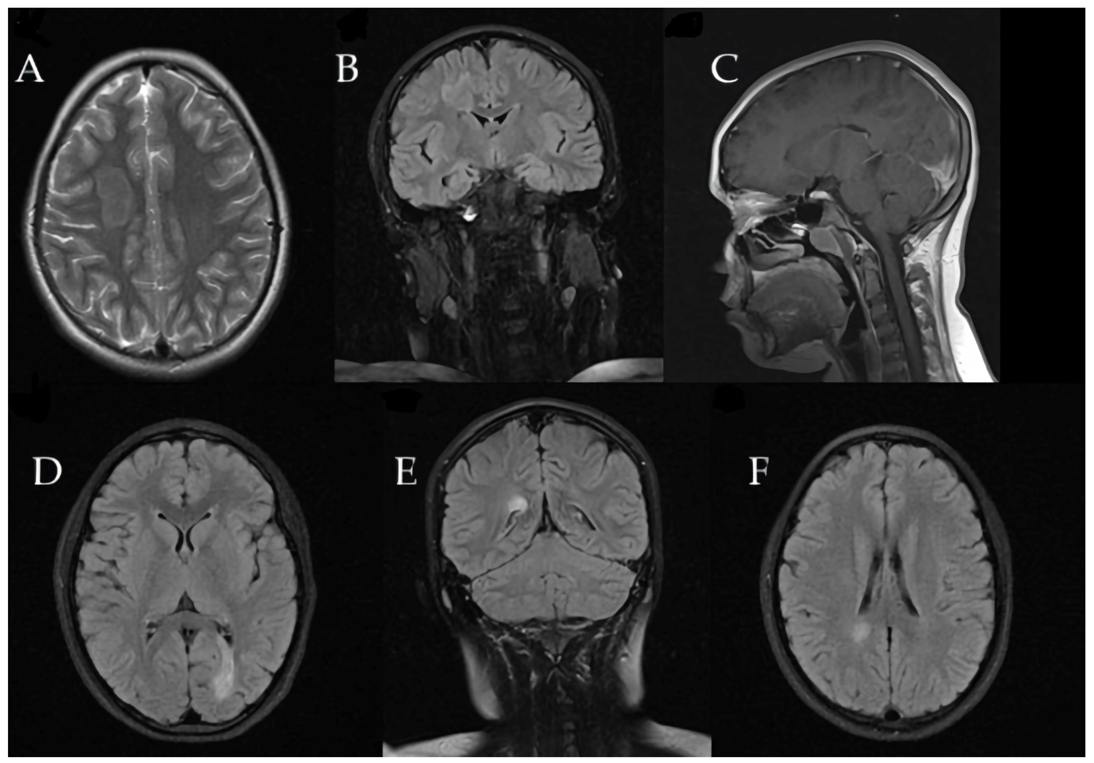 Children 12 00630 g004